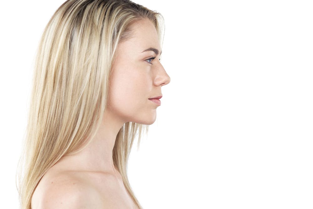 woman after getting a rhinoplasty in Miami, FL