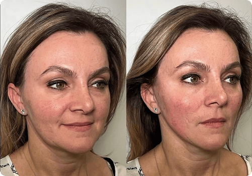 before and after
