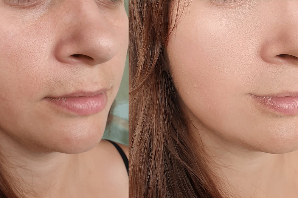 Spotting Quality Results vs. Overdone Treatments