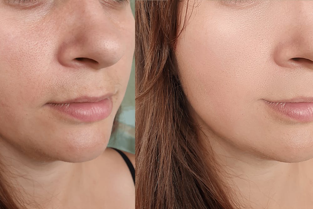 Spotting Quality Results vs. Overdone Treatments