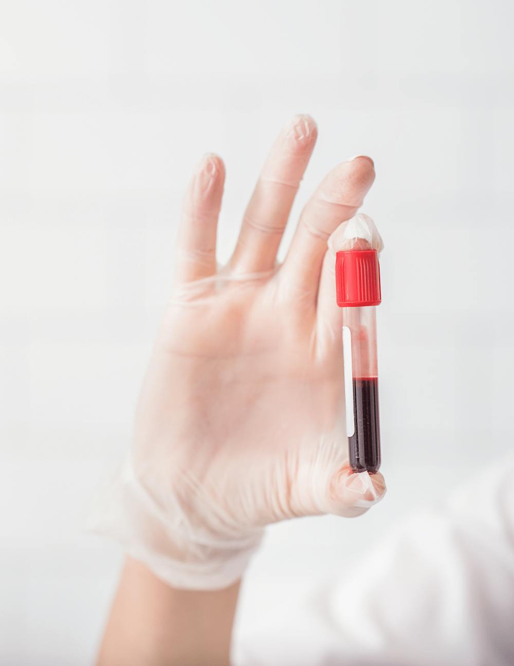 someone holding a vial of blood