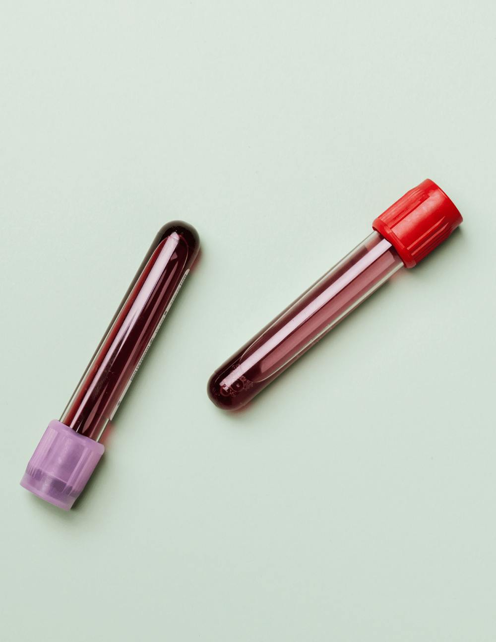 vials of blood