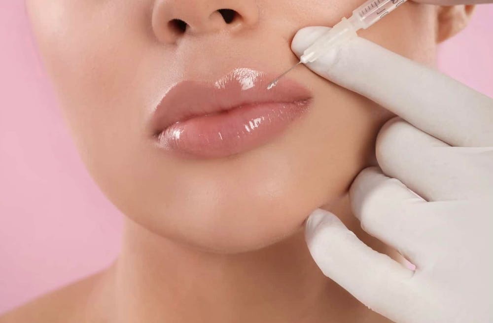 woman getting lip fillers