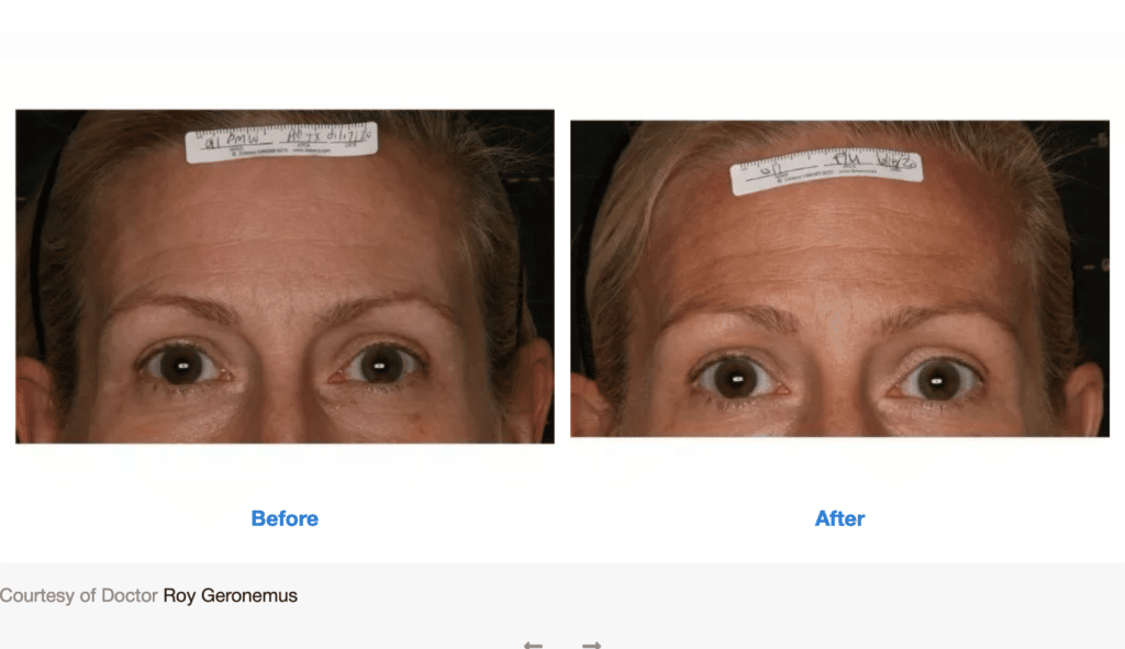 Treatment results screenshot