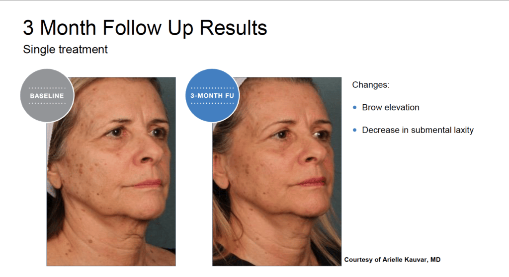 Treatment results screenshot