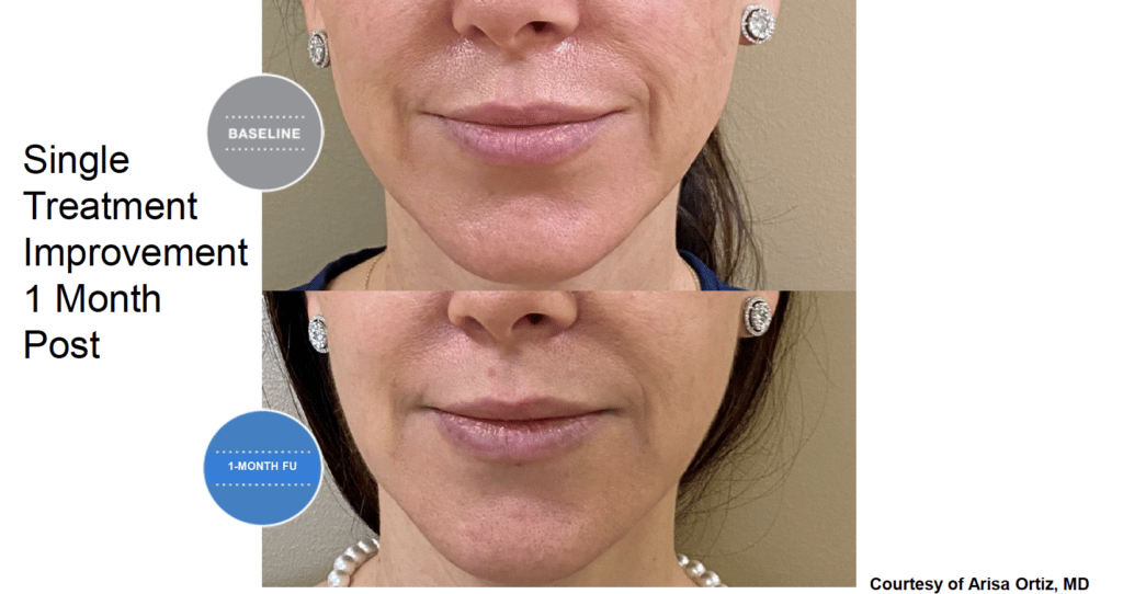 Treatment results screenshot