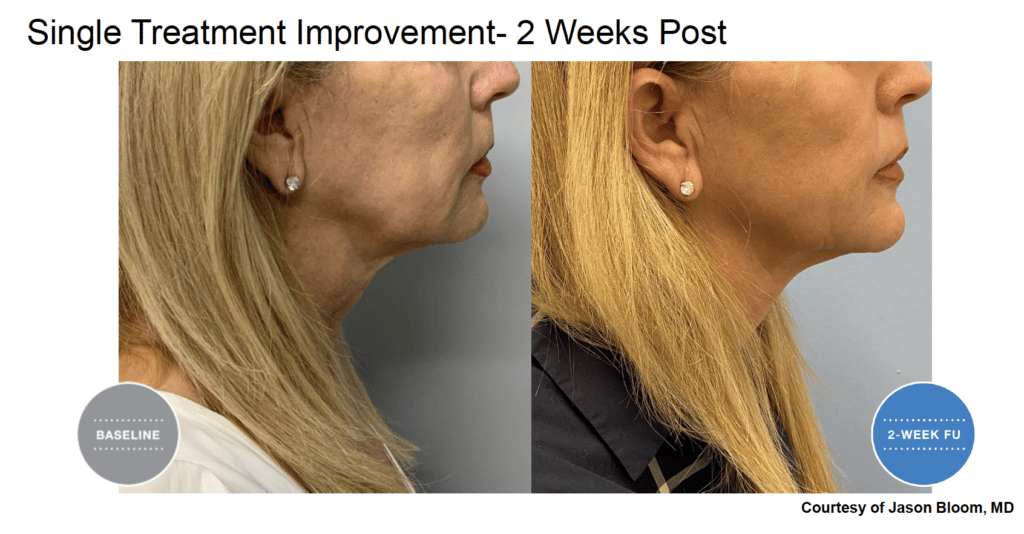 Treatment results screenshot