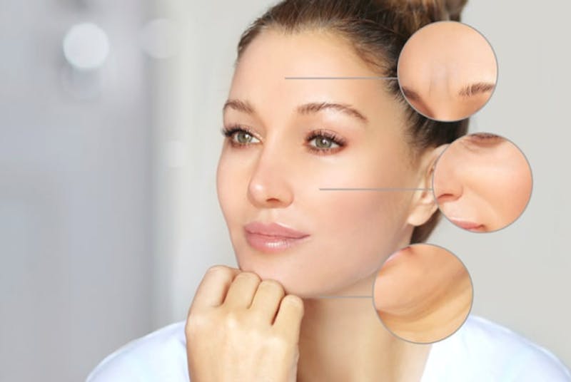 face diagram