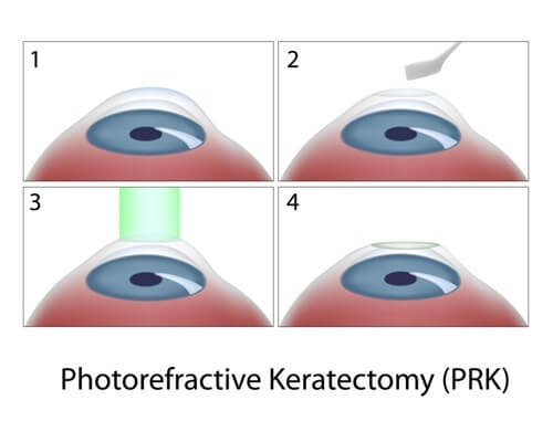 prk graphic