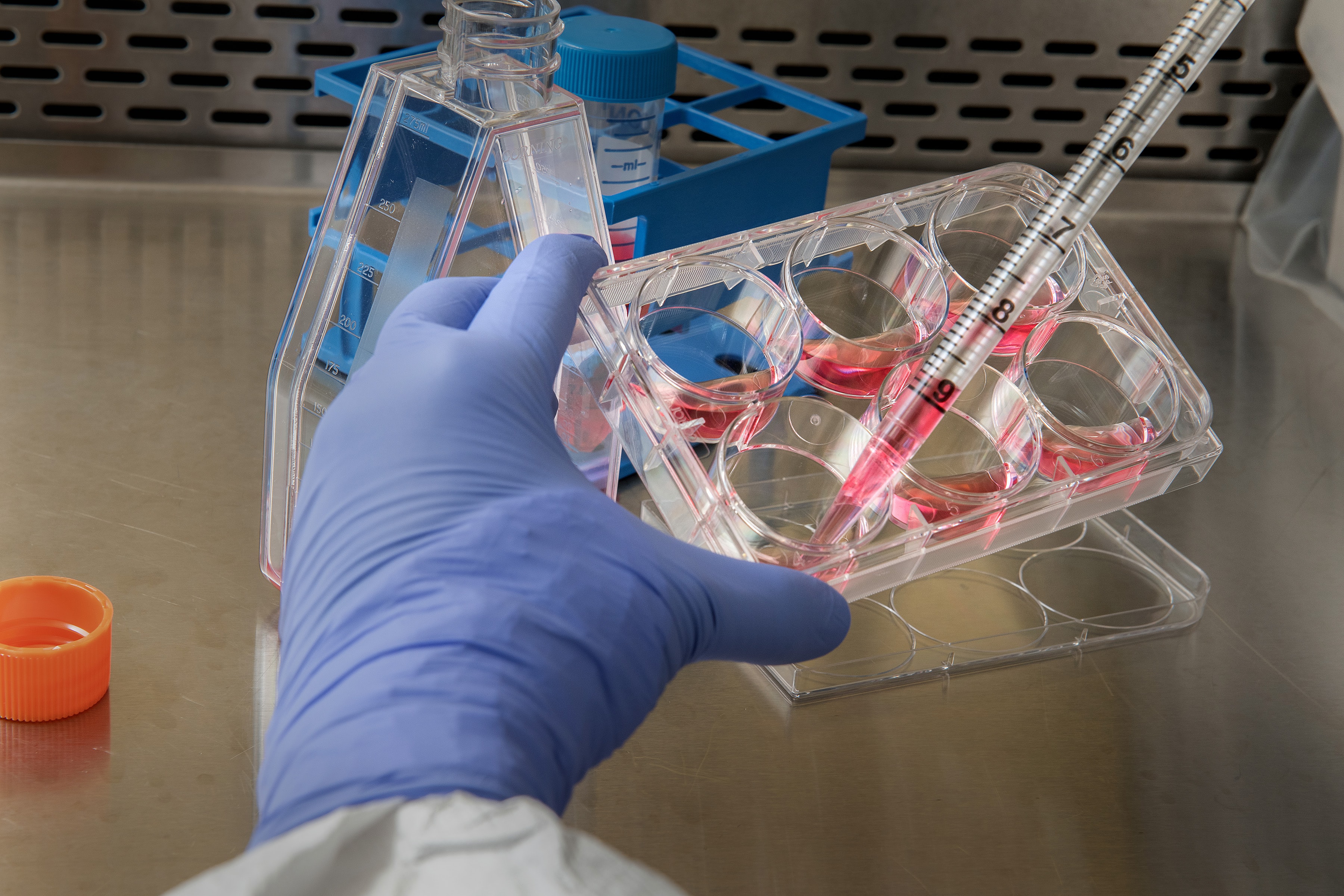 Biohacker wil coronavaccin op zichzelf uittesten