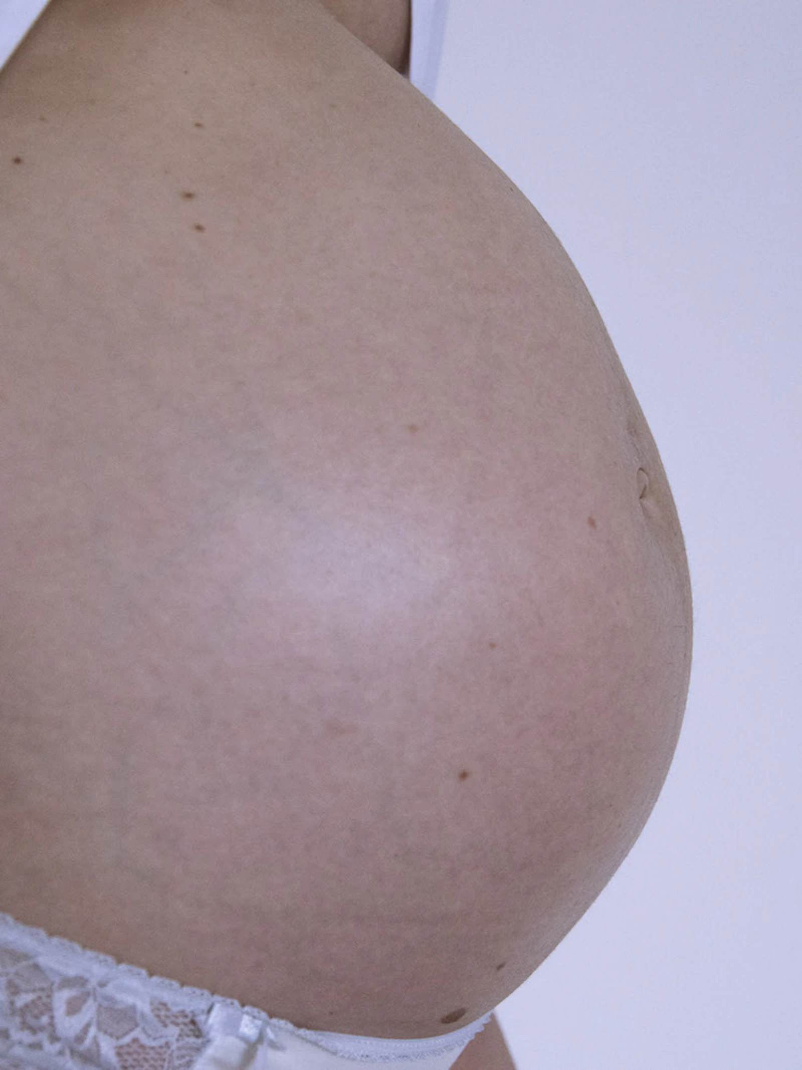 Roet al heel vroeg in placenta