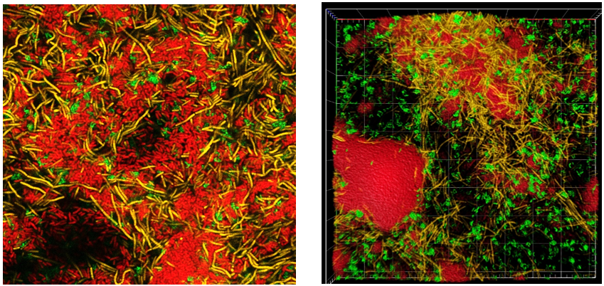 Complexe interacties tussen bacteriesoorten maken biofilms hardnekkig
