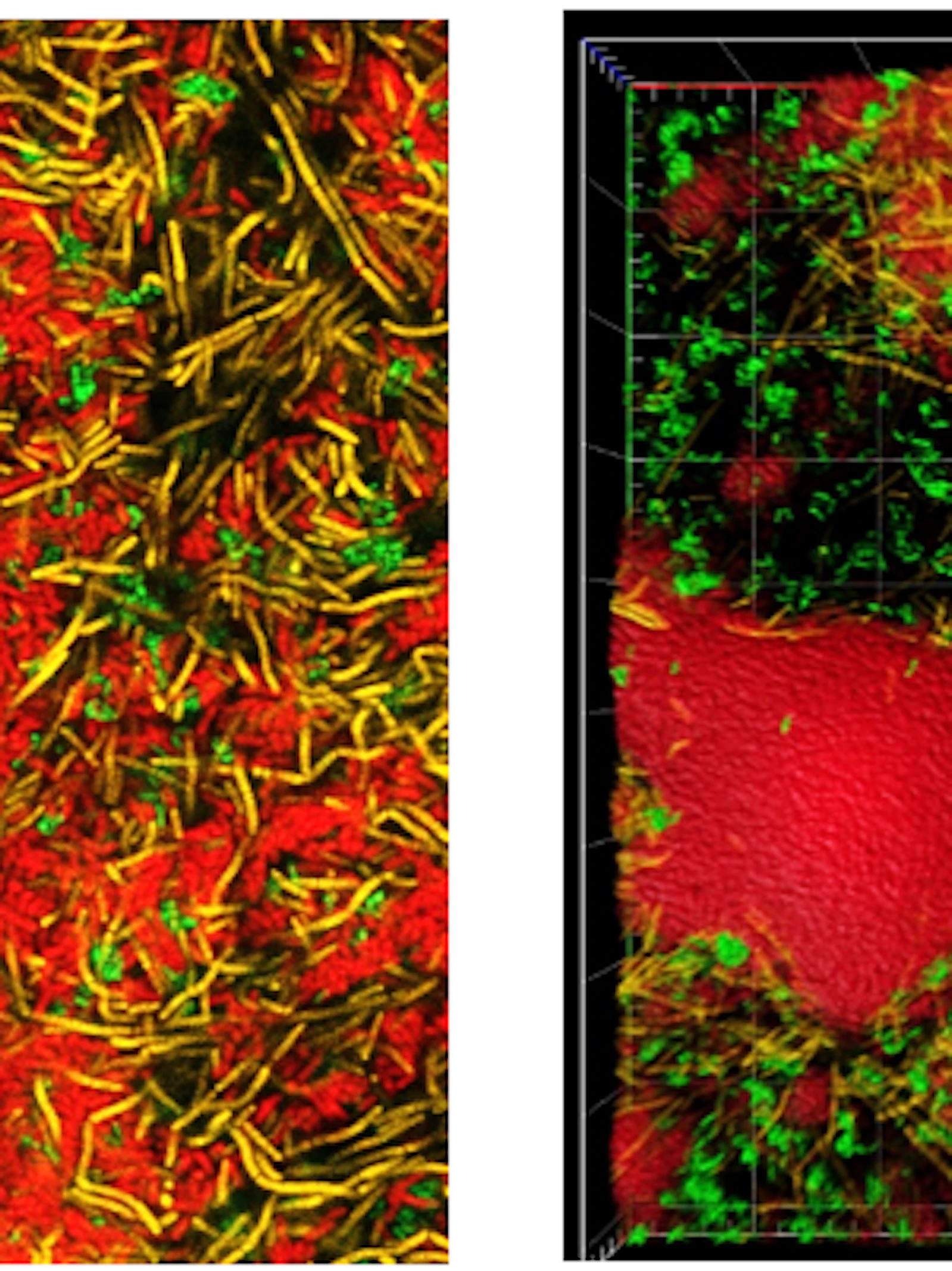 Confocal laser electron microscopy images of multispecies biofilms Complexe interacties tussen bacteriesoorten maken biofilms hardnekkig