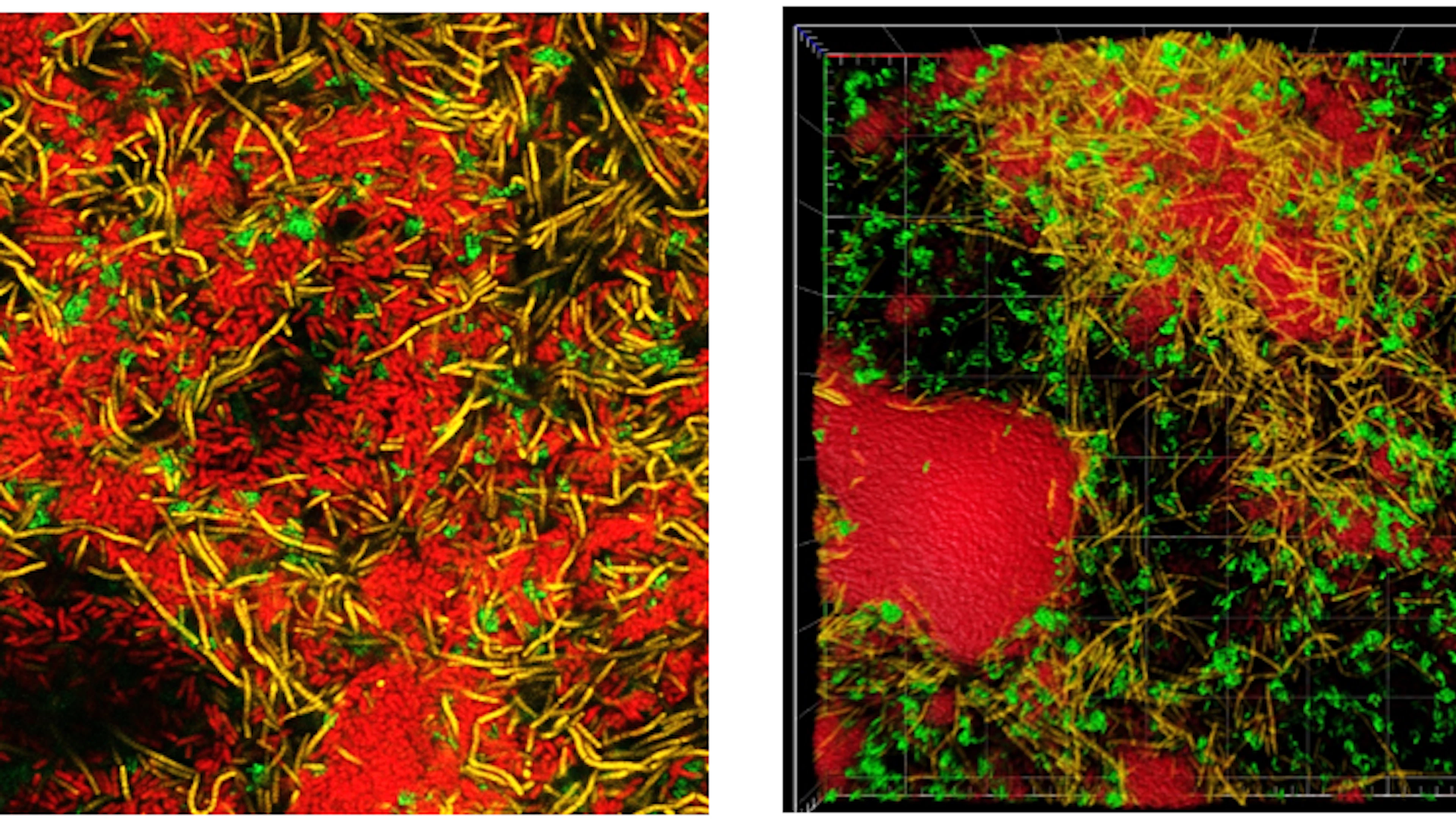 Confocal laser electron microscopy images of multispecies biofilms Complexe interacties tussen bacteriesoorten maken biofilms hardnekkig