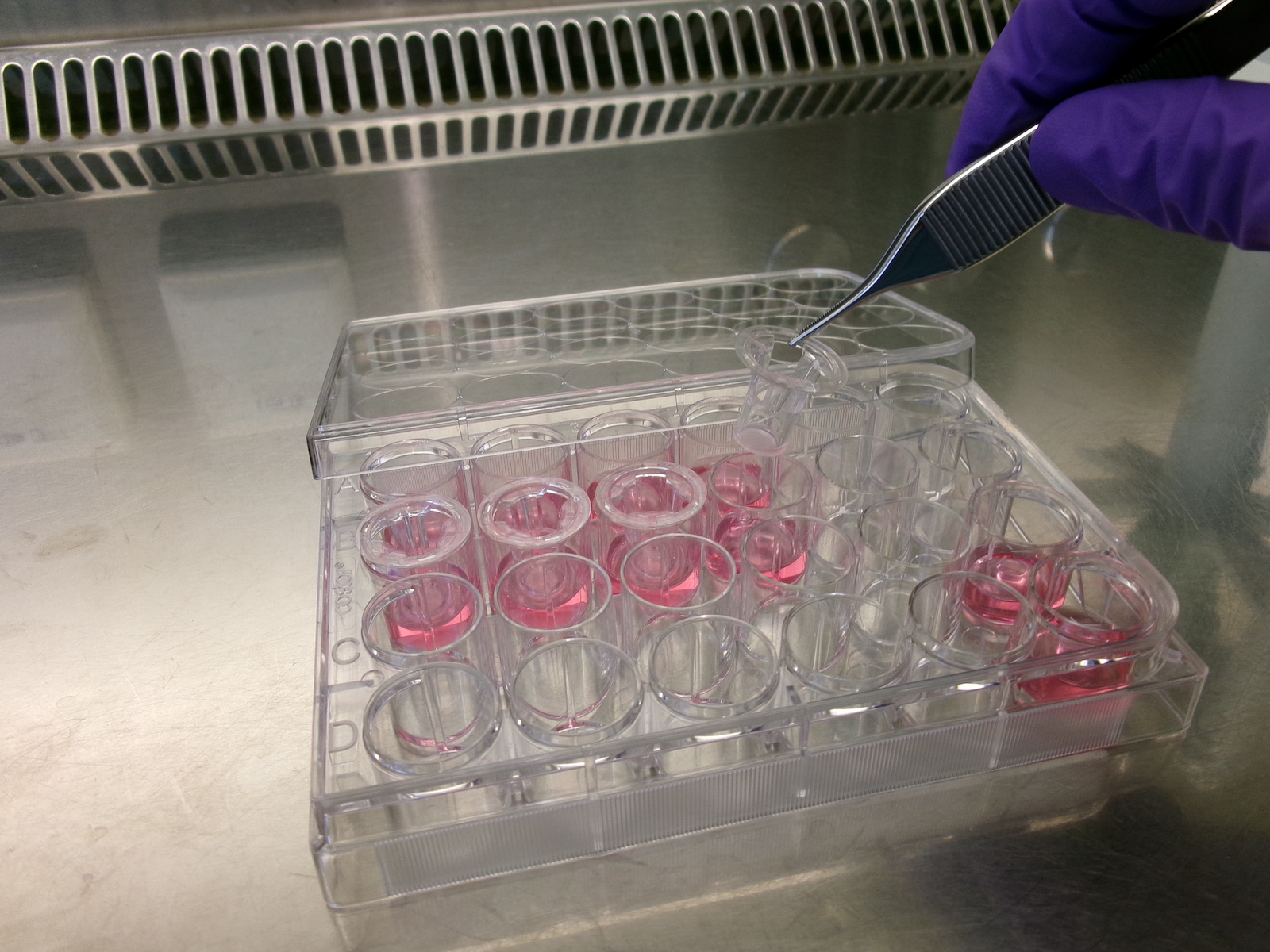 Jouw longen in het lab in de strijd tegen virussen