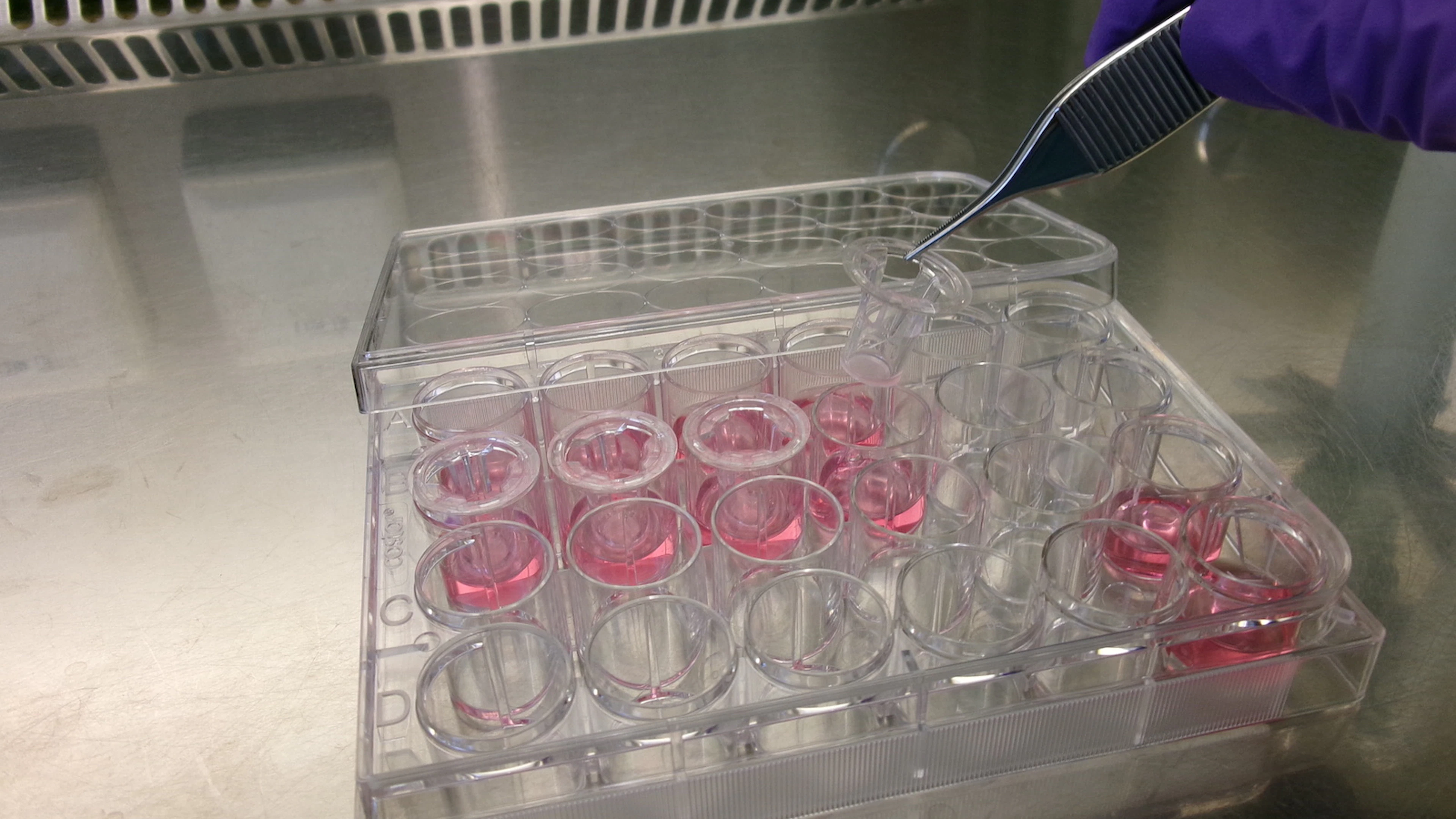 Jouw longen in het lab in de strijd tegen virussen