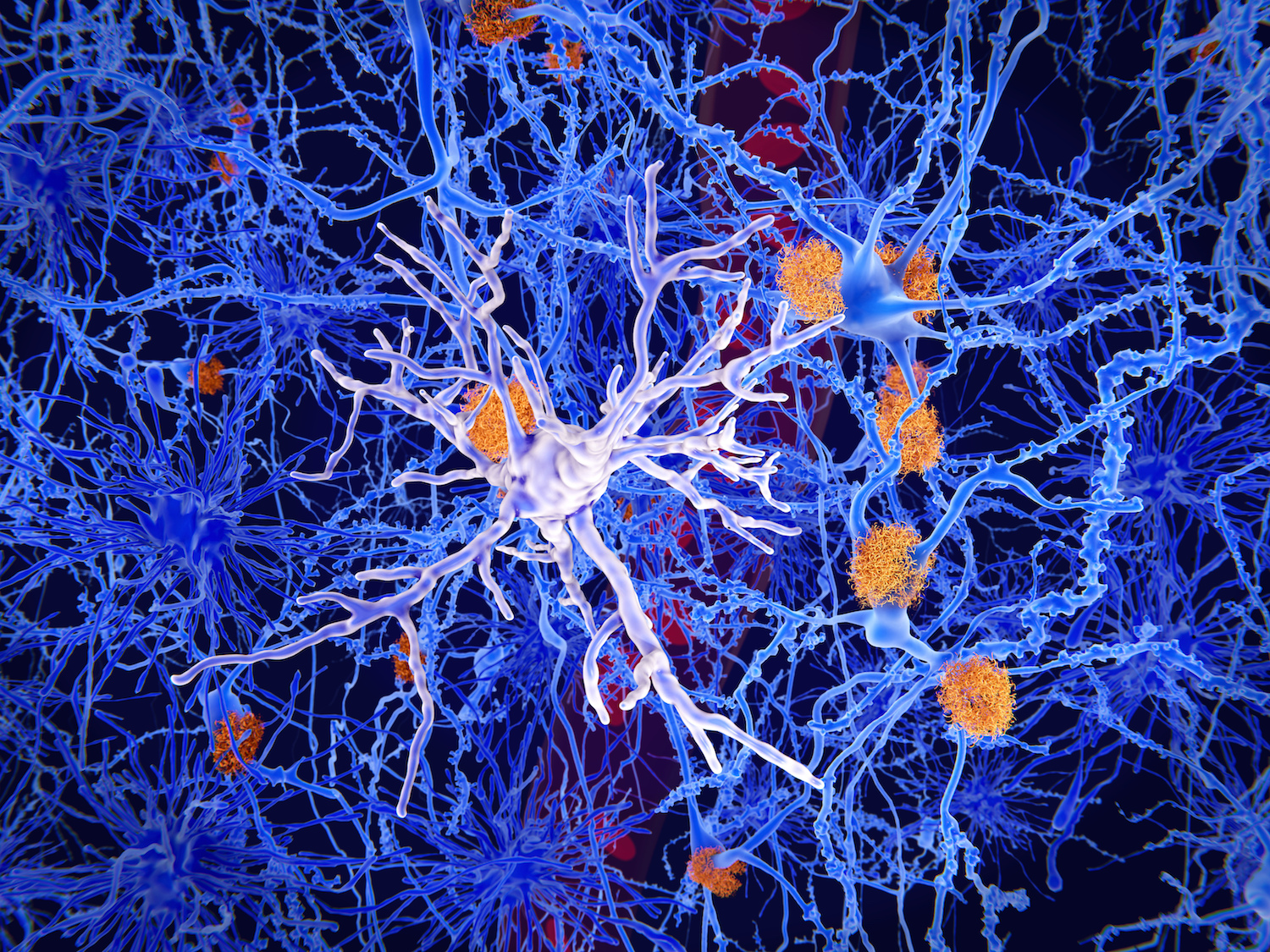 Focus op microglia bij behandeling tegen alzheimer
