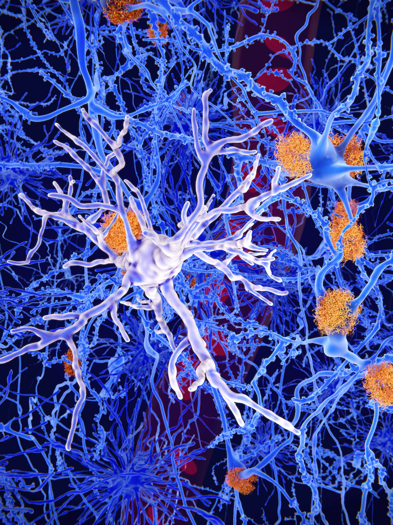 Focus op microglia bij behandeling tegen alzheimer
