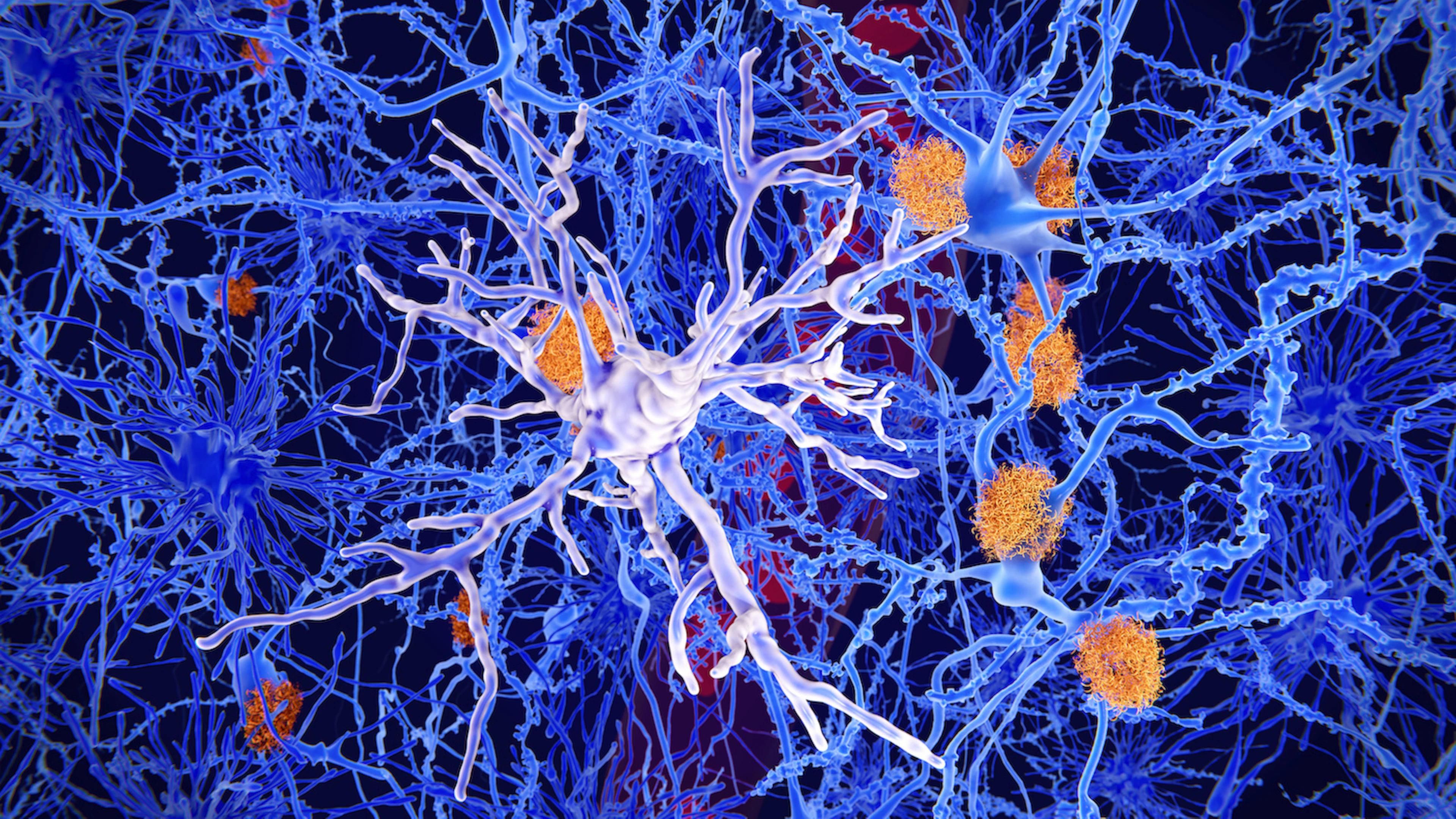Focus op microglia bij behandeling tegen alzheimer