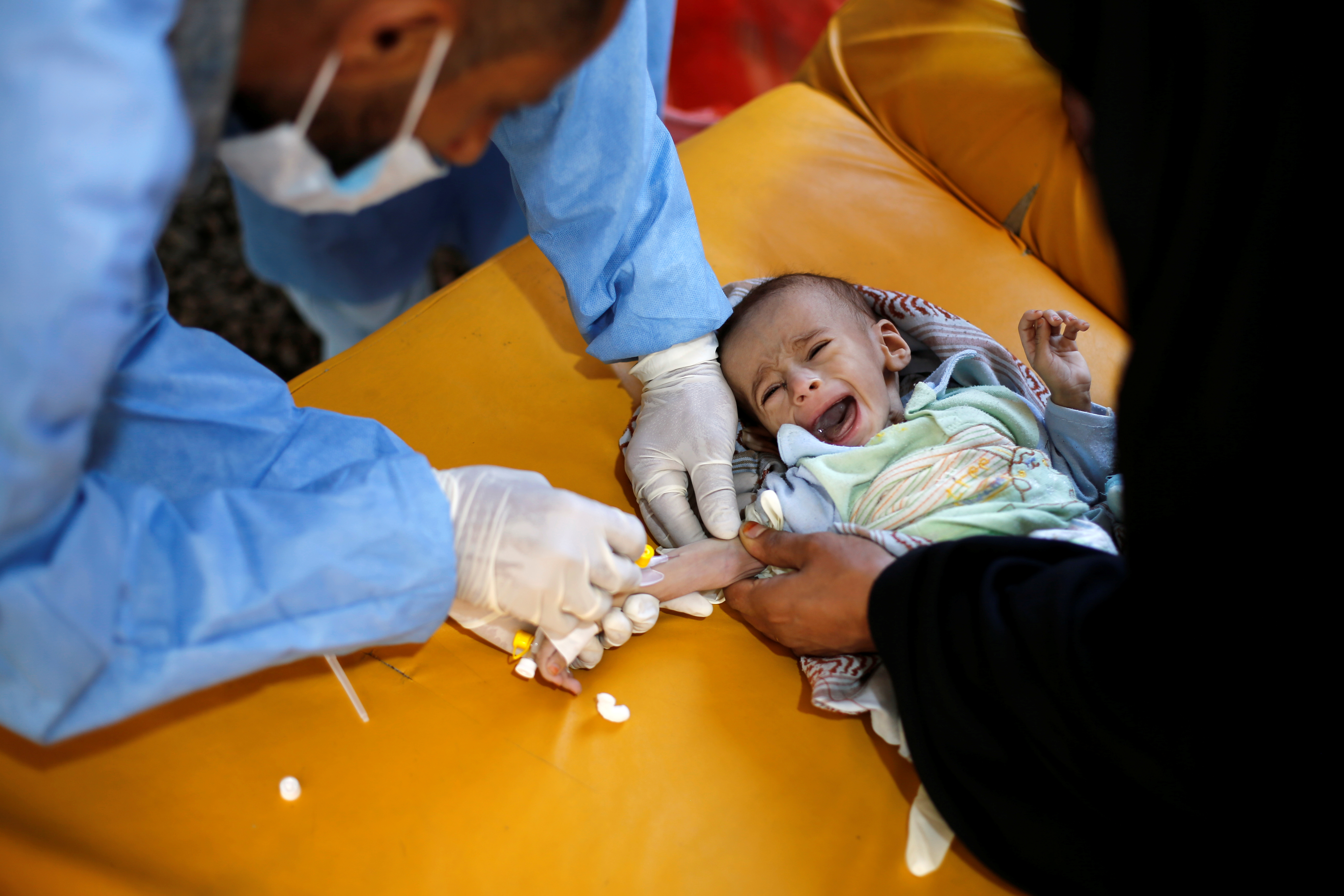 Cholera bereikte Jemen vanuit Afrika