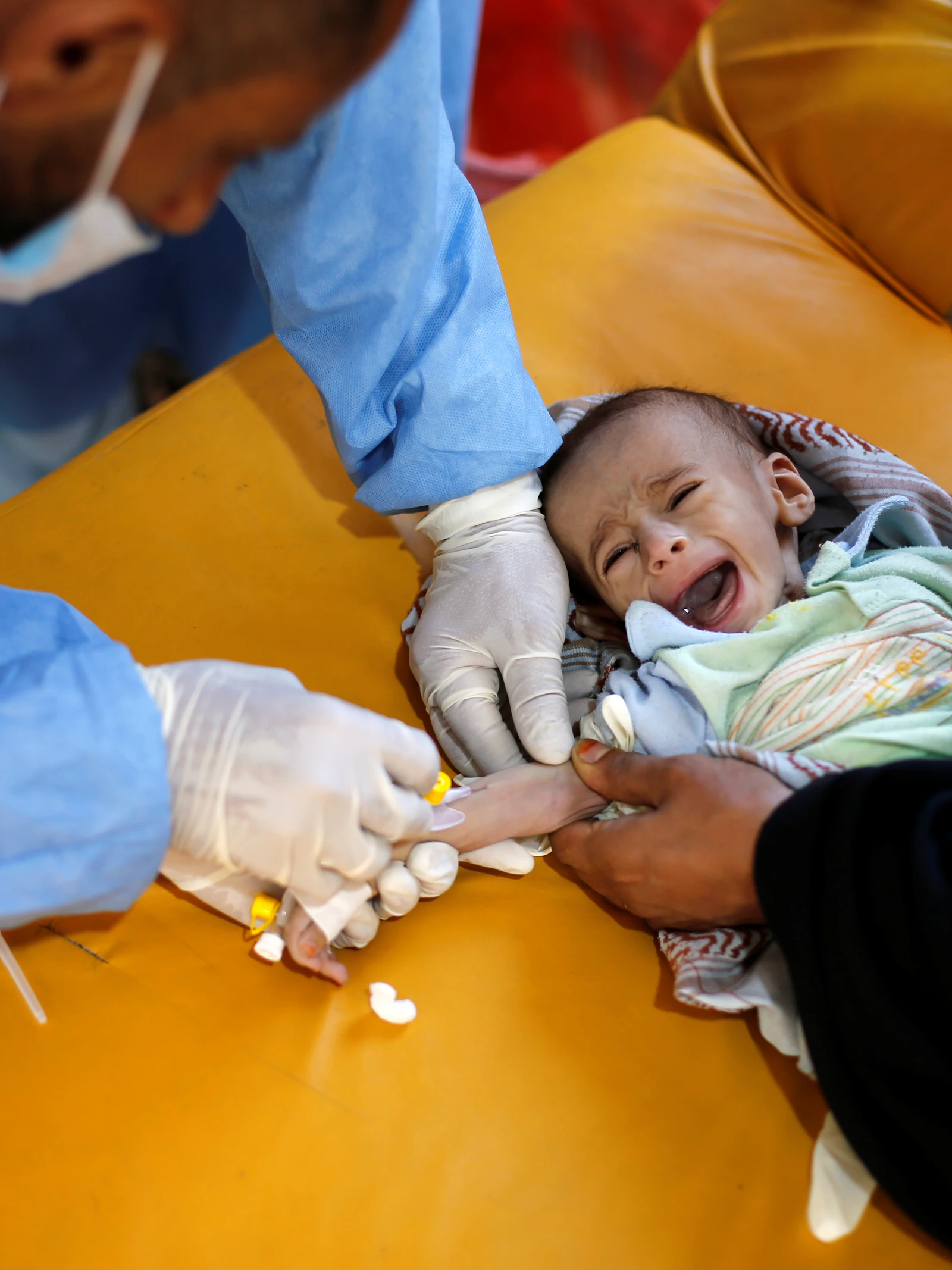 Cholera bereikte Jemen vanuit Afrika