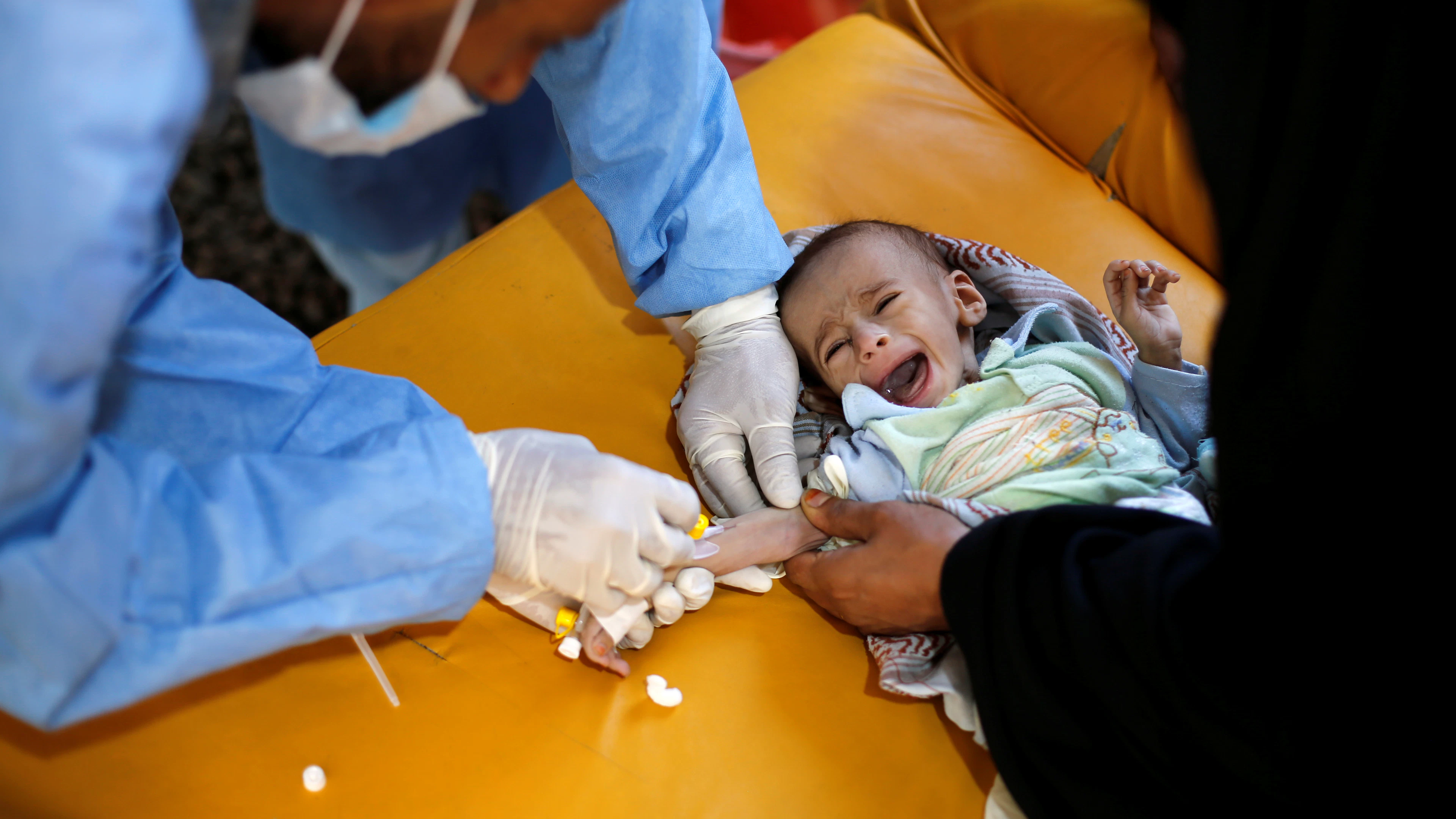 Cholera bereikte Jemen vanuit Afrika
