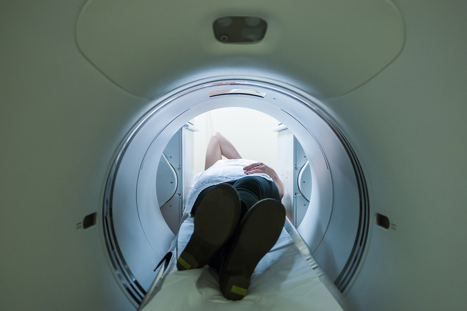 Aantal kankerdoden neemt steile duik (in VS)