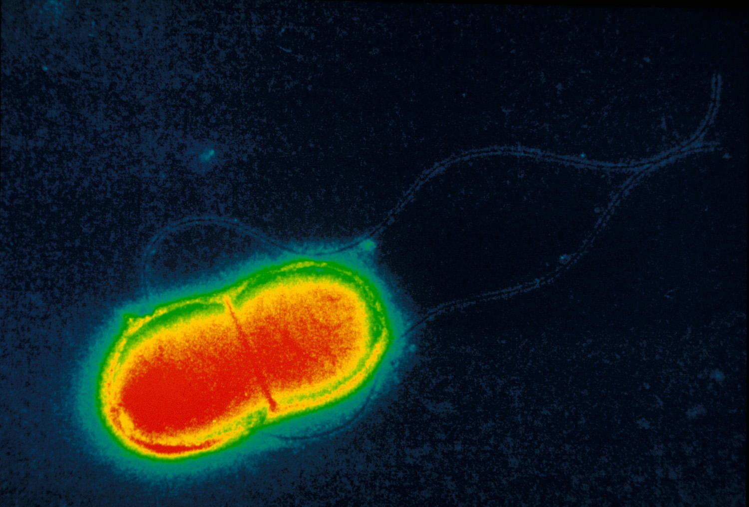 Bacteriën sporen mee kanker op