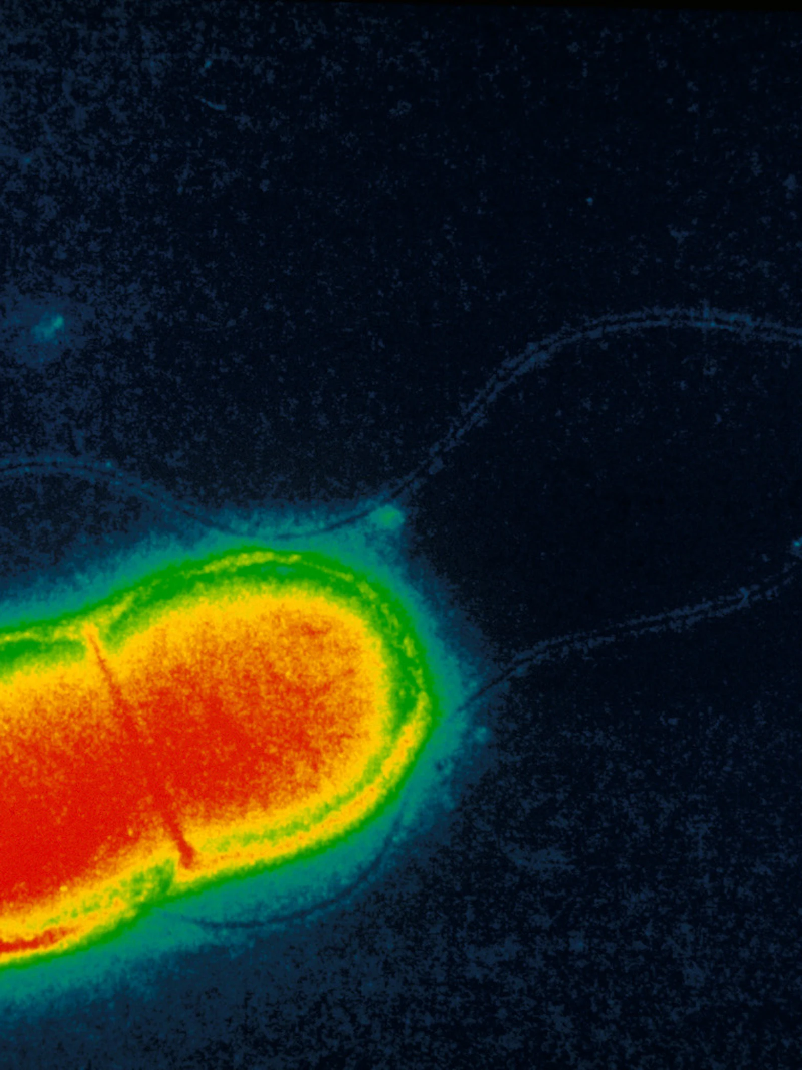 Bacteriën sporen mee kanker op