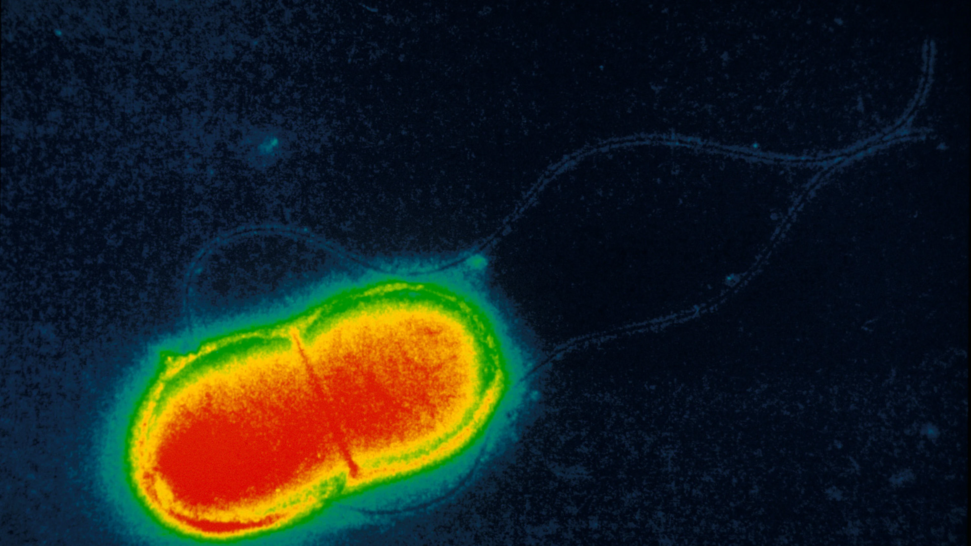 Bacteriën sporen mee kanker op