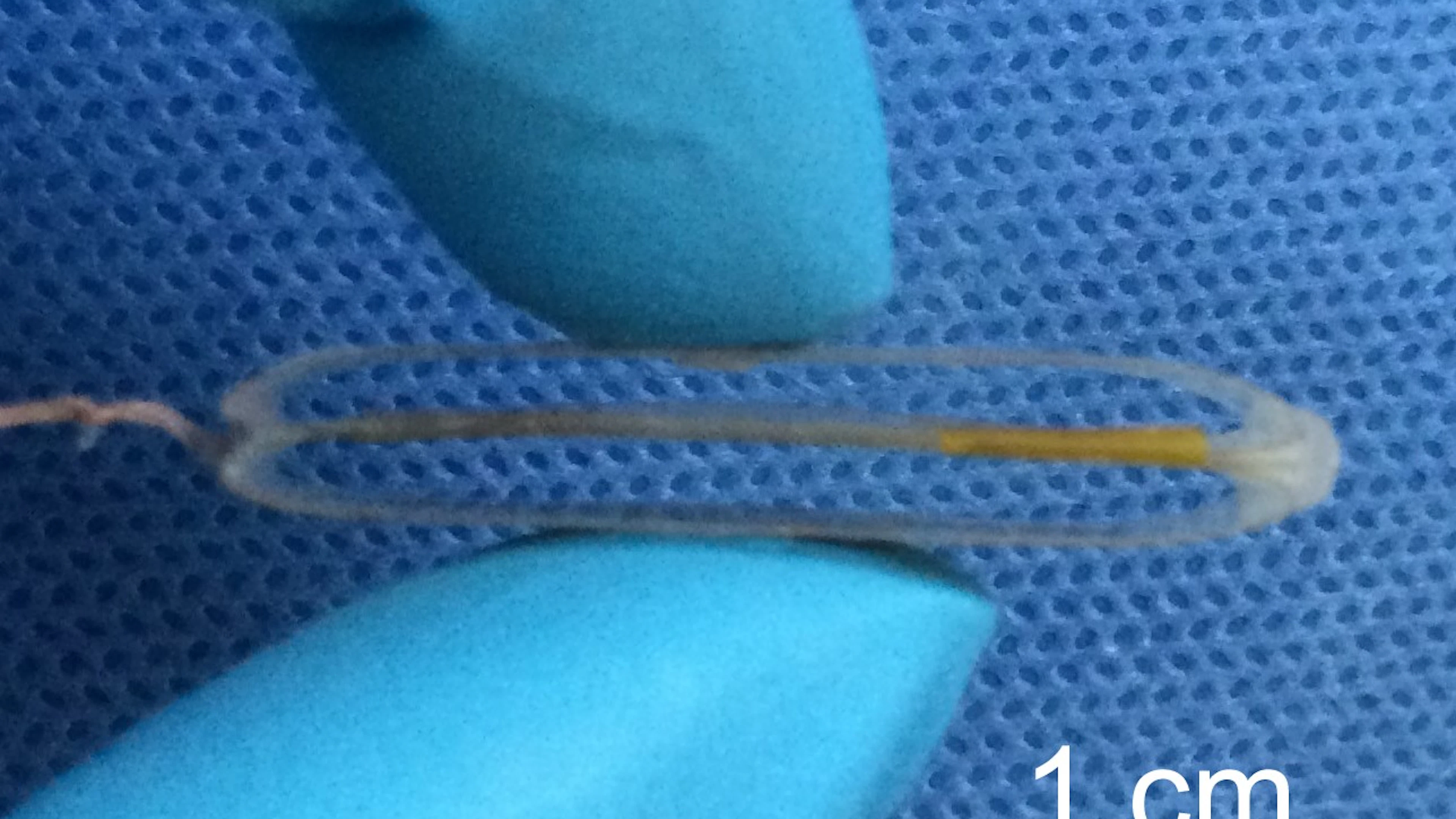 Pacemaker zonder batterijen