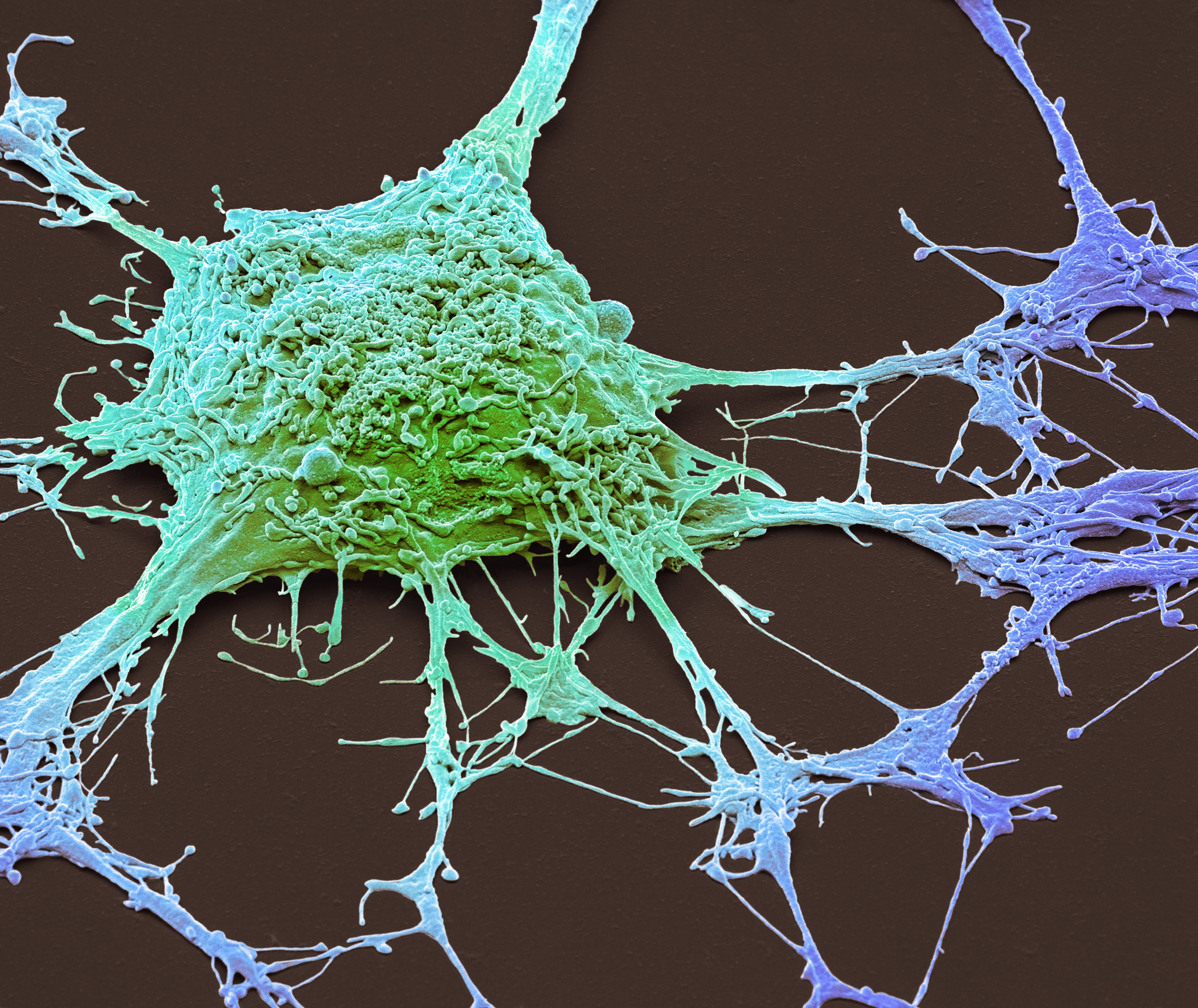 Belgische doorbraak in 3D-microscopie