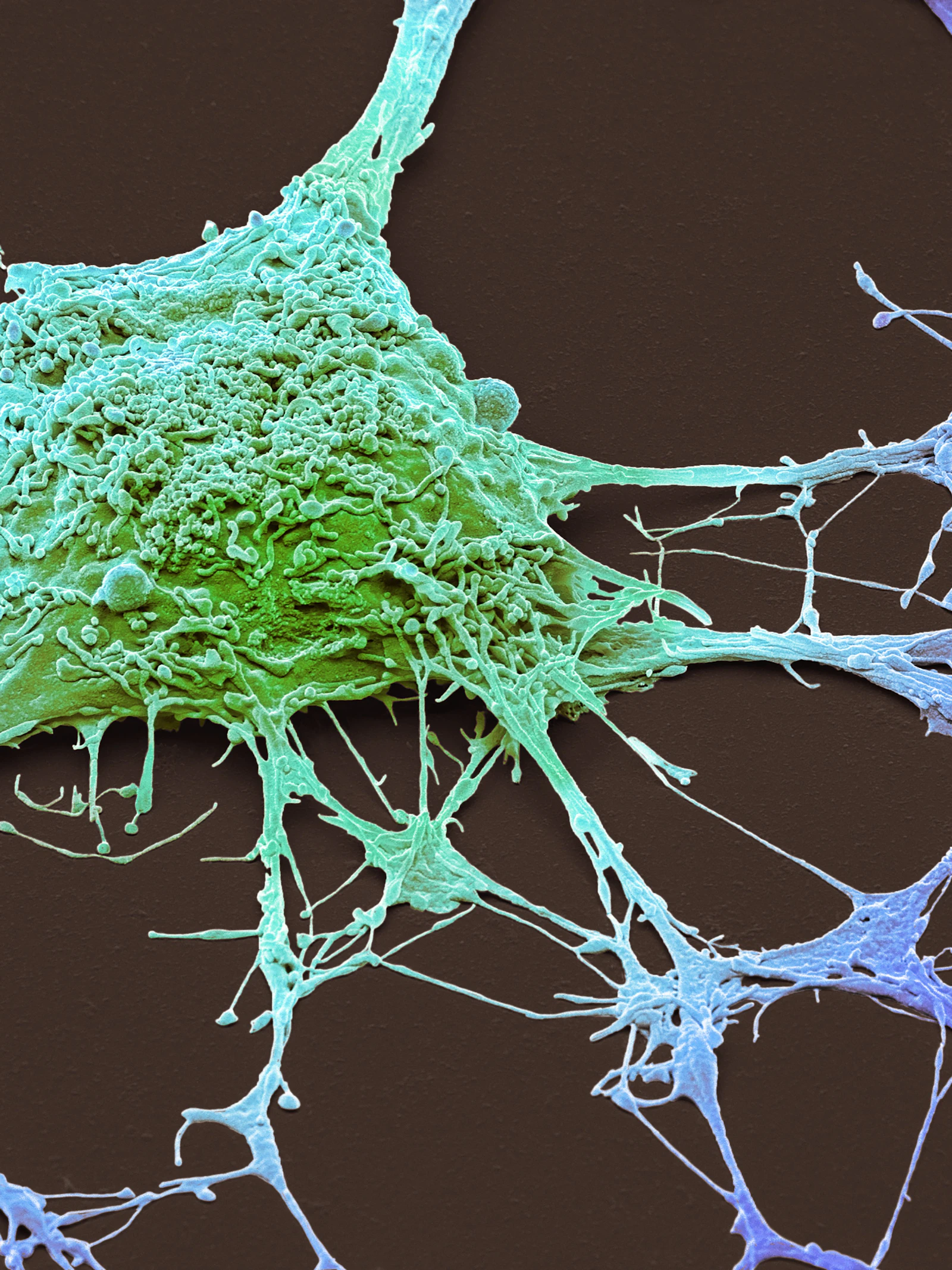 Belgische doorbraak in 3D-microscopie