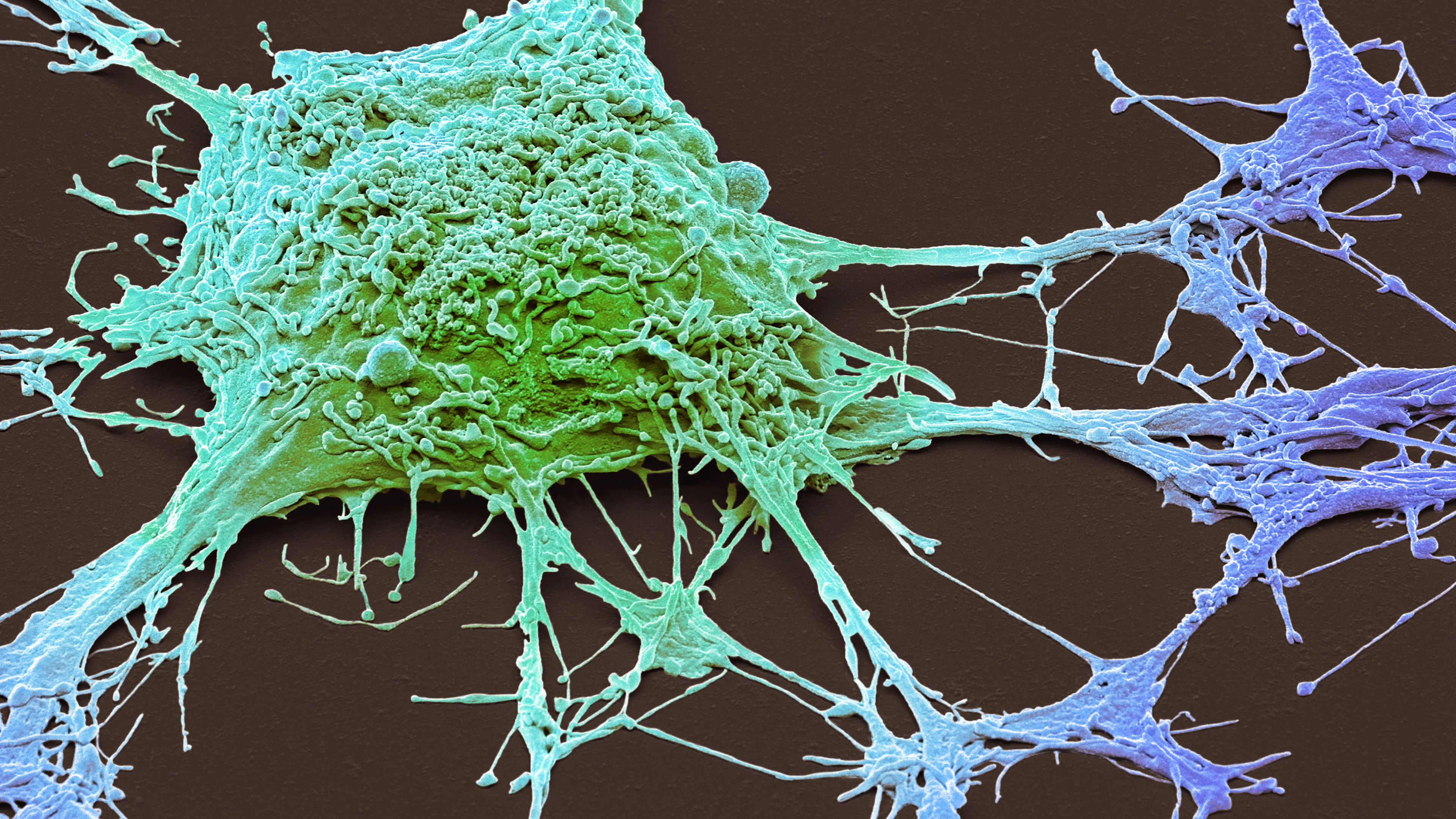 Belgische doorbraak in 3D-microscopie