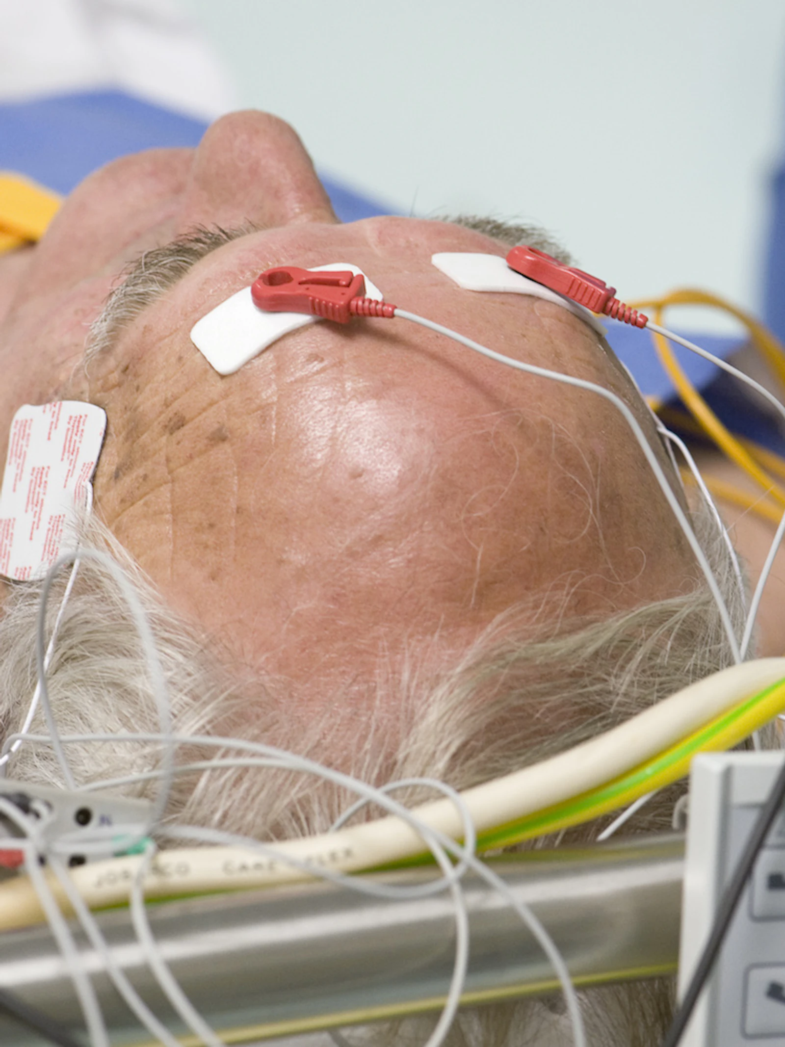 Depressie-behandeling maakt nieuwe hersencellen aan