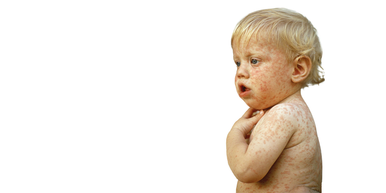 Strategieën om vaccinweigeraars te overtuigen