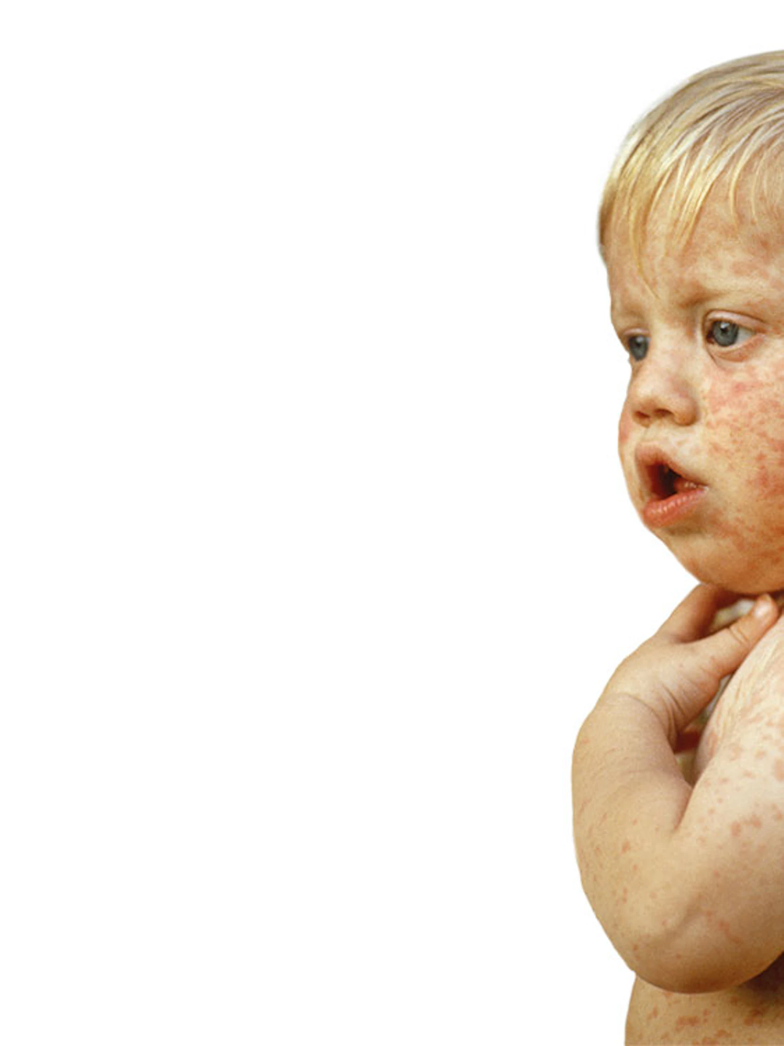Strategieën om vaccinweigeraars te overtuigen