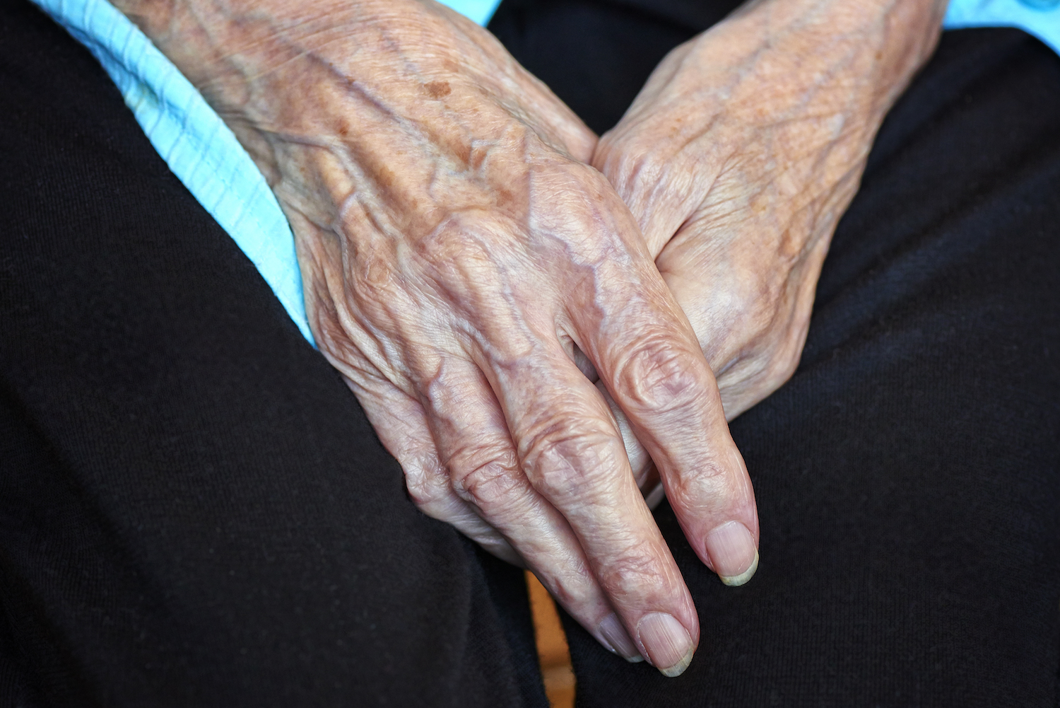 Nieuwe behandeling voor artritis?