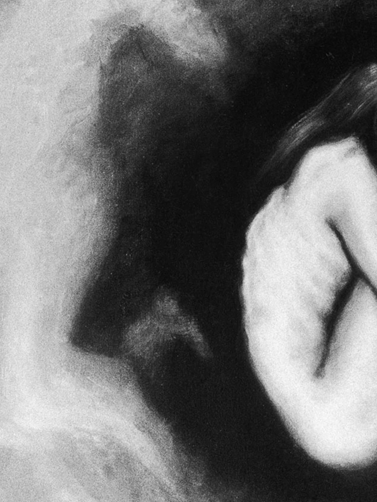 Anorexia is ook een lichamelijke aandoening