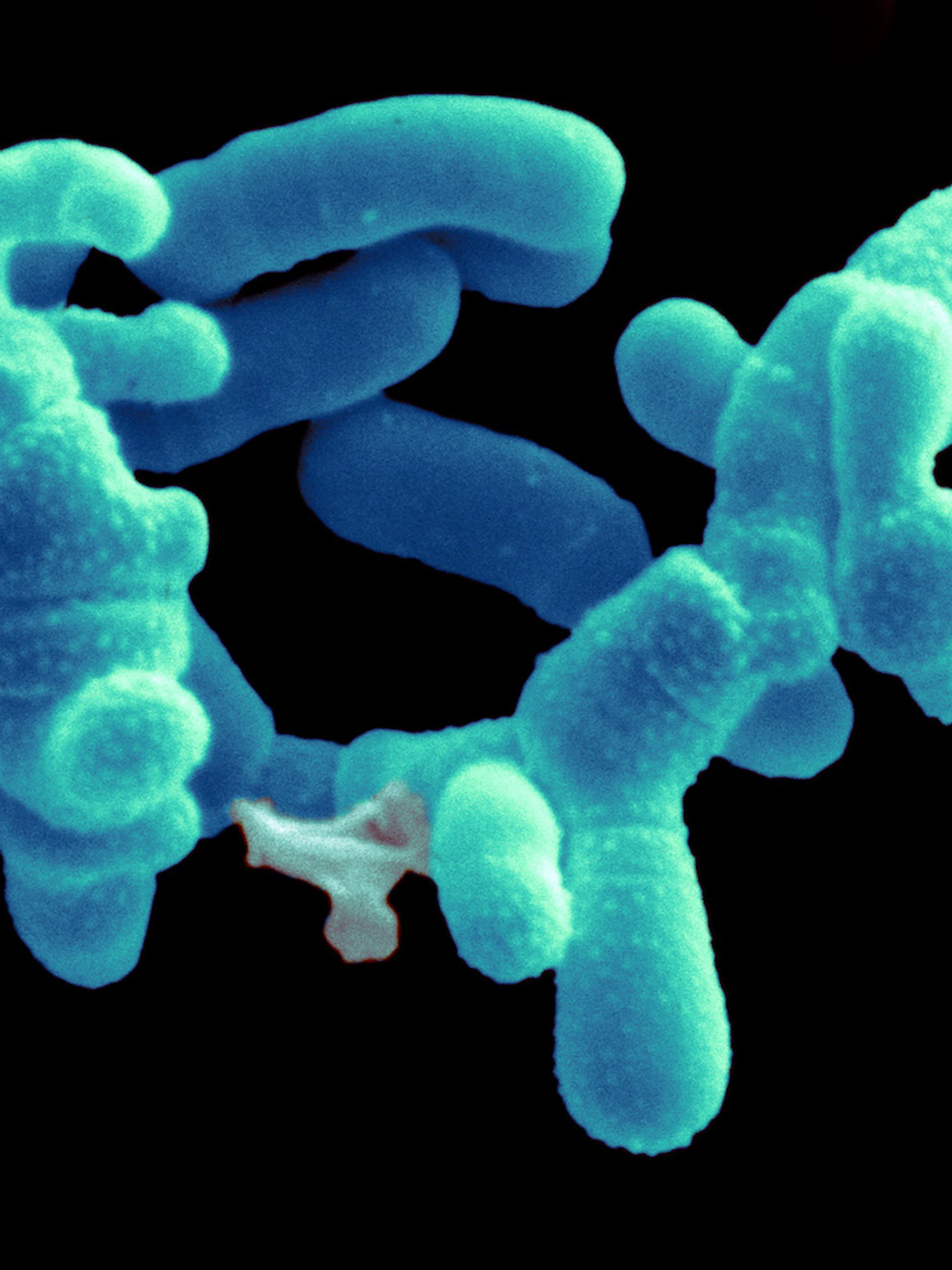Pijnsyndroom fibromyalgie gaat gepaard met gewijzigde darmflora