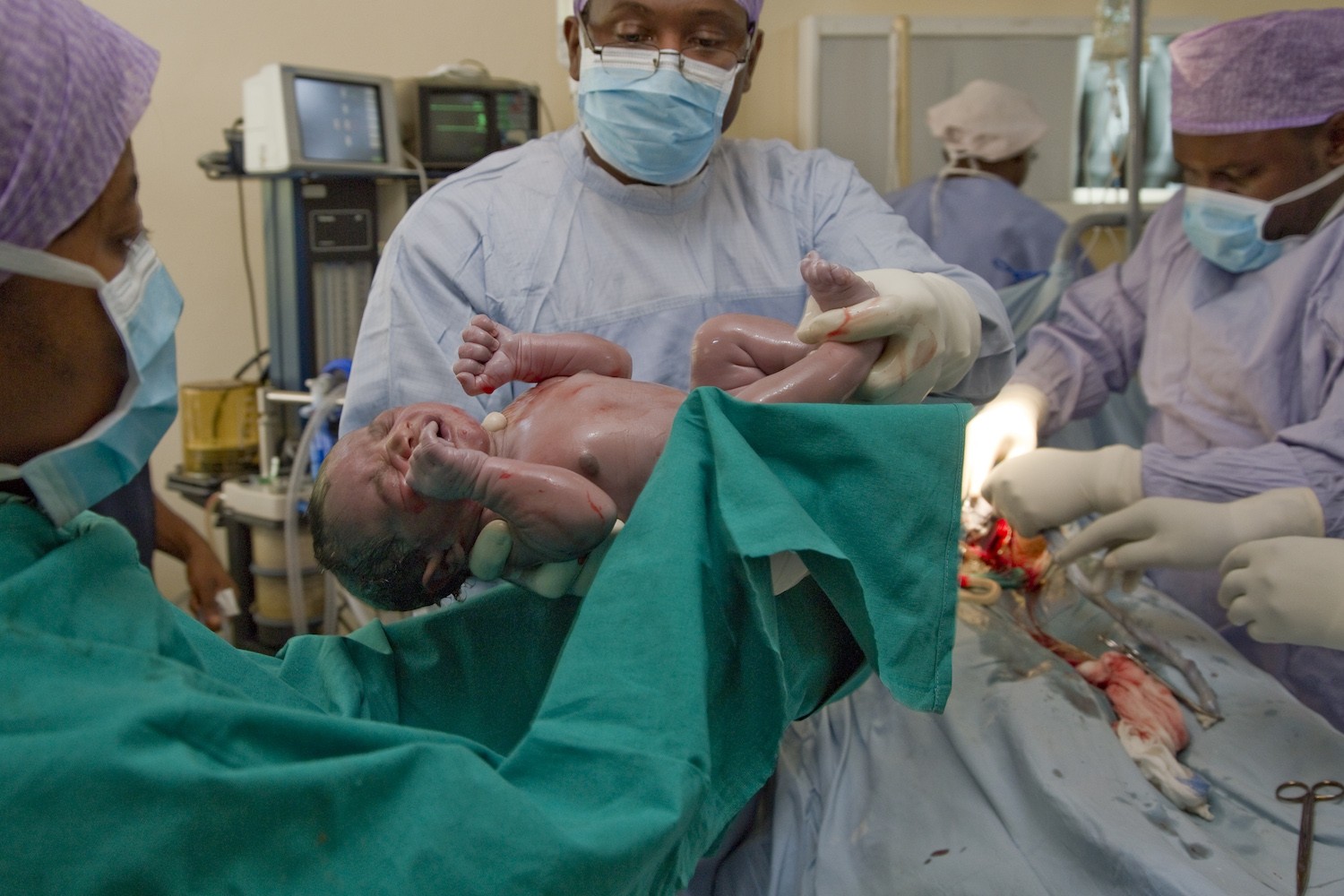 Heeft een baby de vaginale bacteriën van zijn moeder nodig?