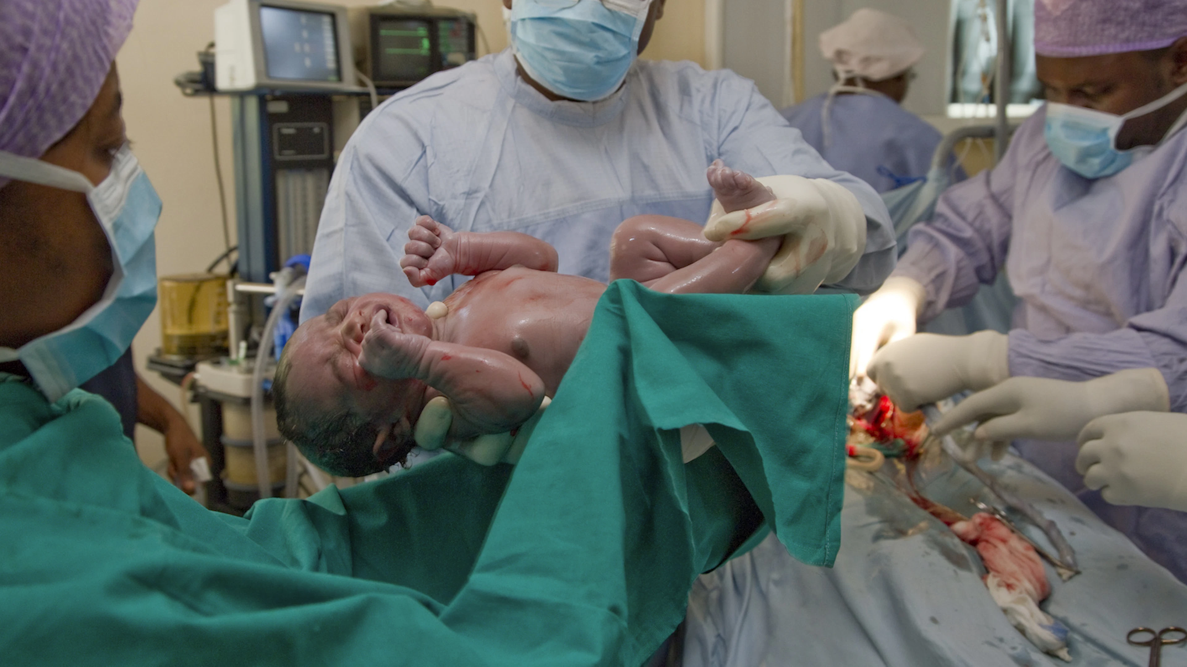 Heeft een baby de vaginale bacteriën van zijn moeder nodig?