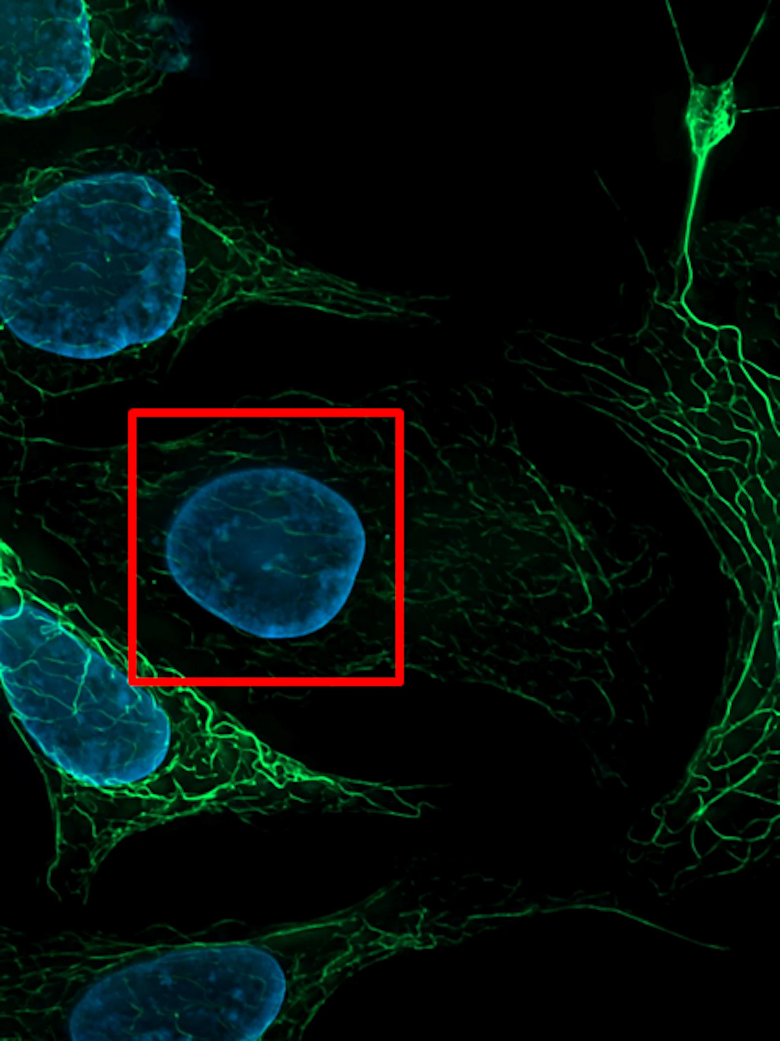 Foto:Zeiss Microscopy;creativecommons.org/licenses/by/2.0/legalcode;adapted Algoritme ontmaskert frauderende wetenschappers