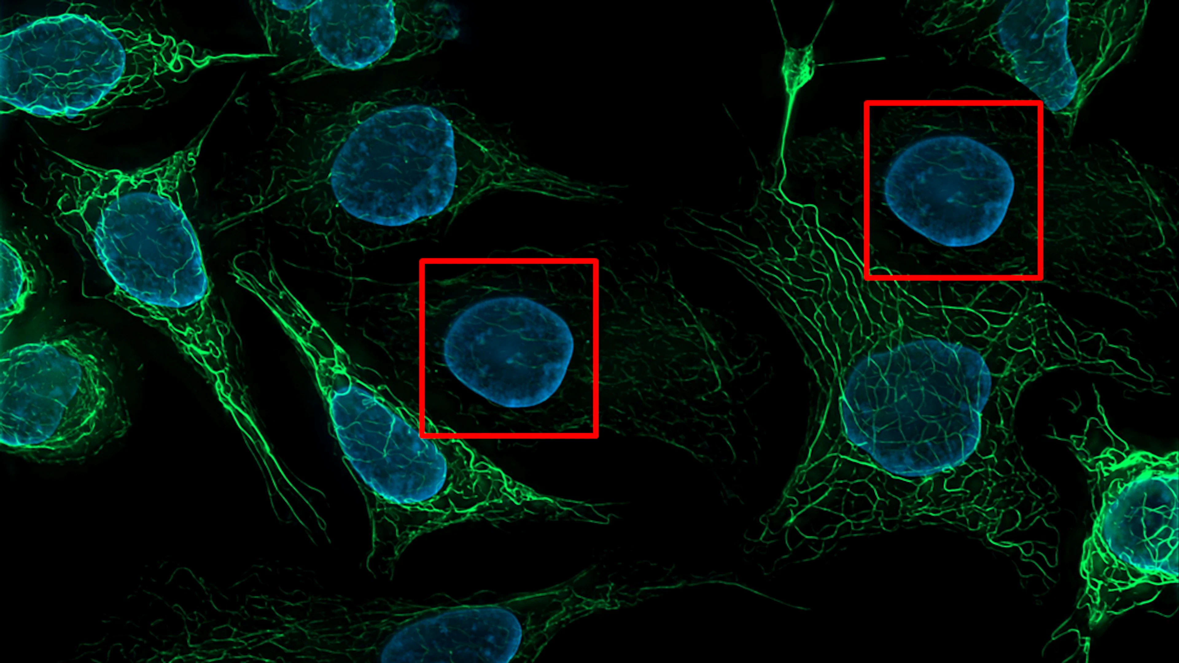 Foto:Zeiss Microscopy;creativecommons.org/licenses/by/2.0/legalcode;adapted Algoritme ontmaskert frauderende wetenschappers