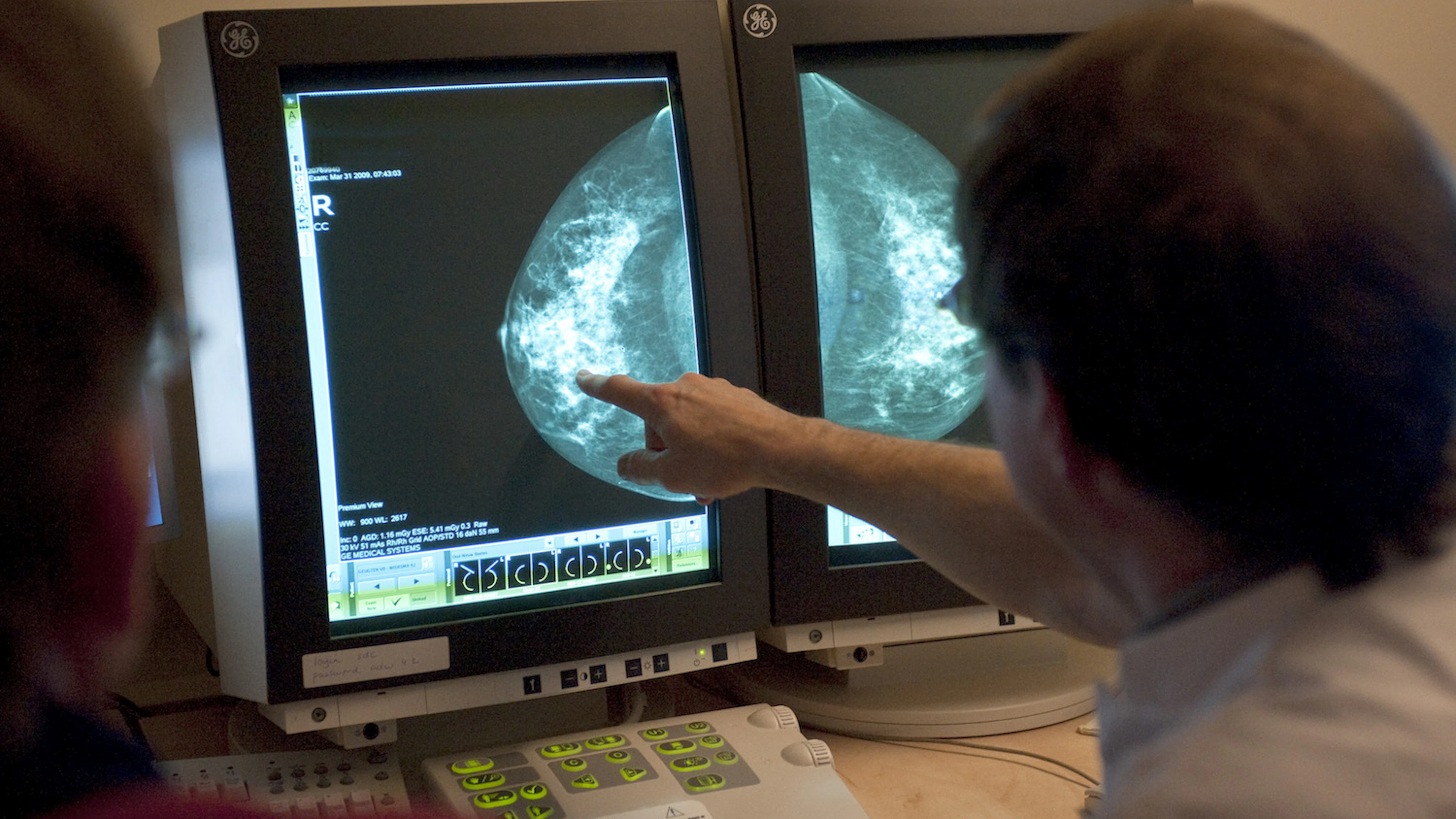 Kunnen slimme computerprogramma's borstkanker opsporen?