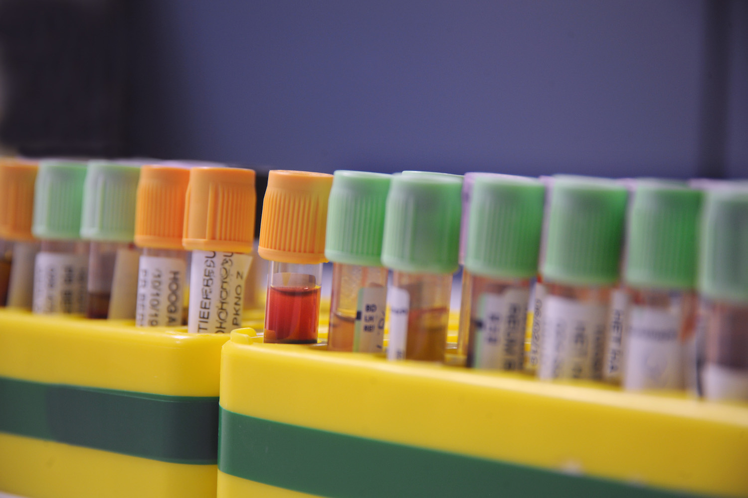 Urinetest spoort uitzaaiingen op