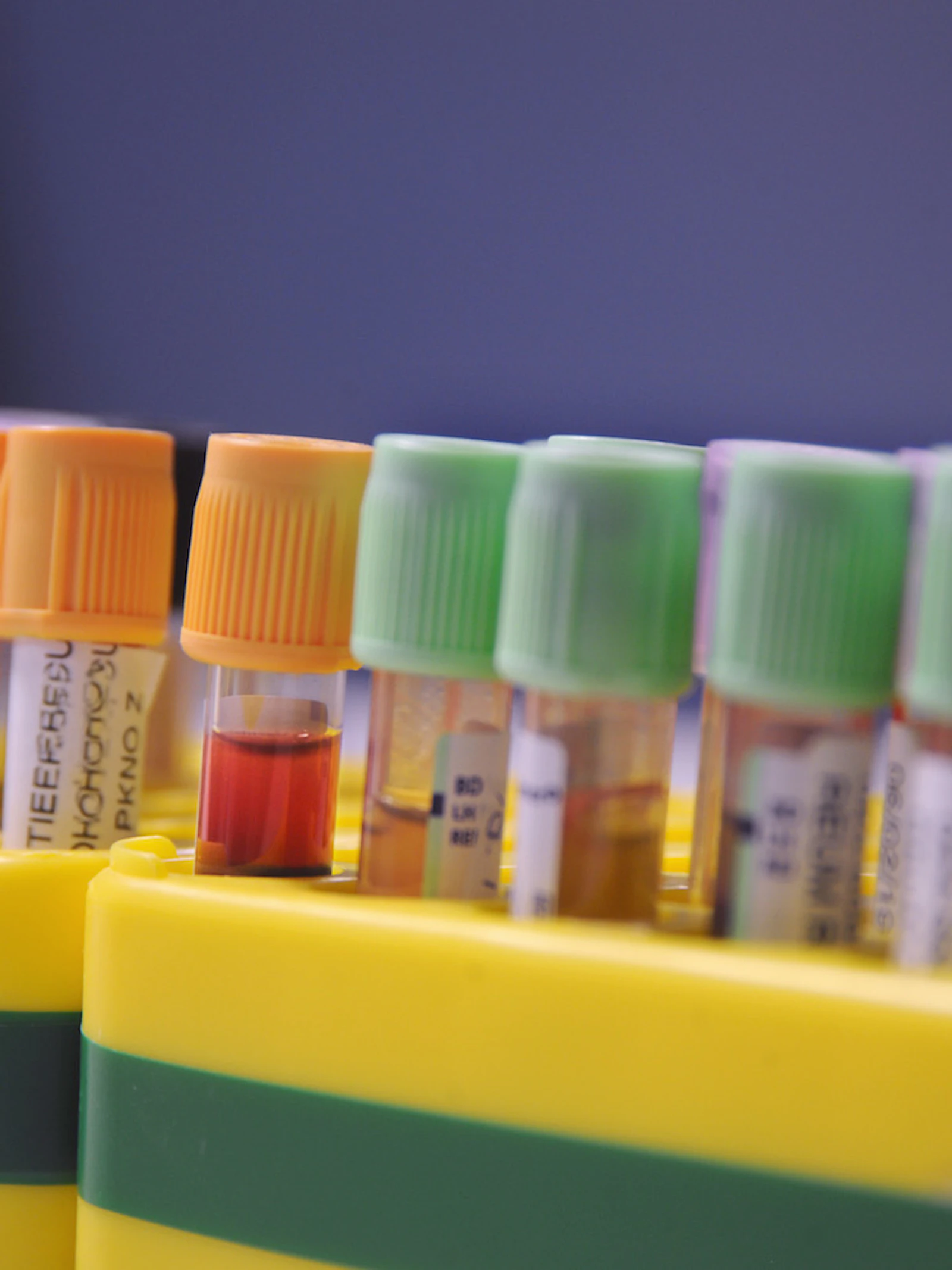 Urinetest spoort uitzaaiingen op