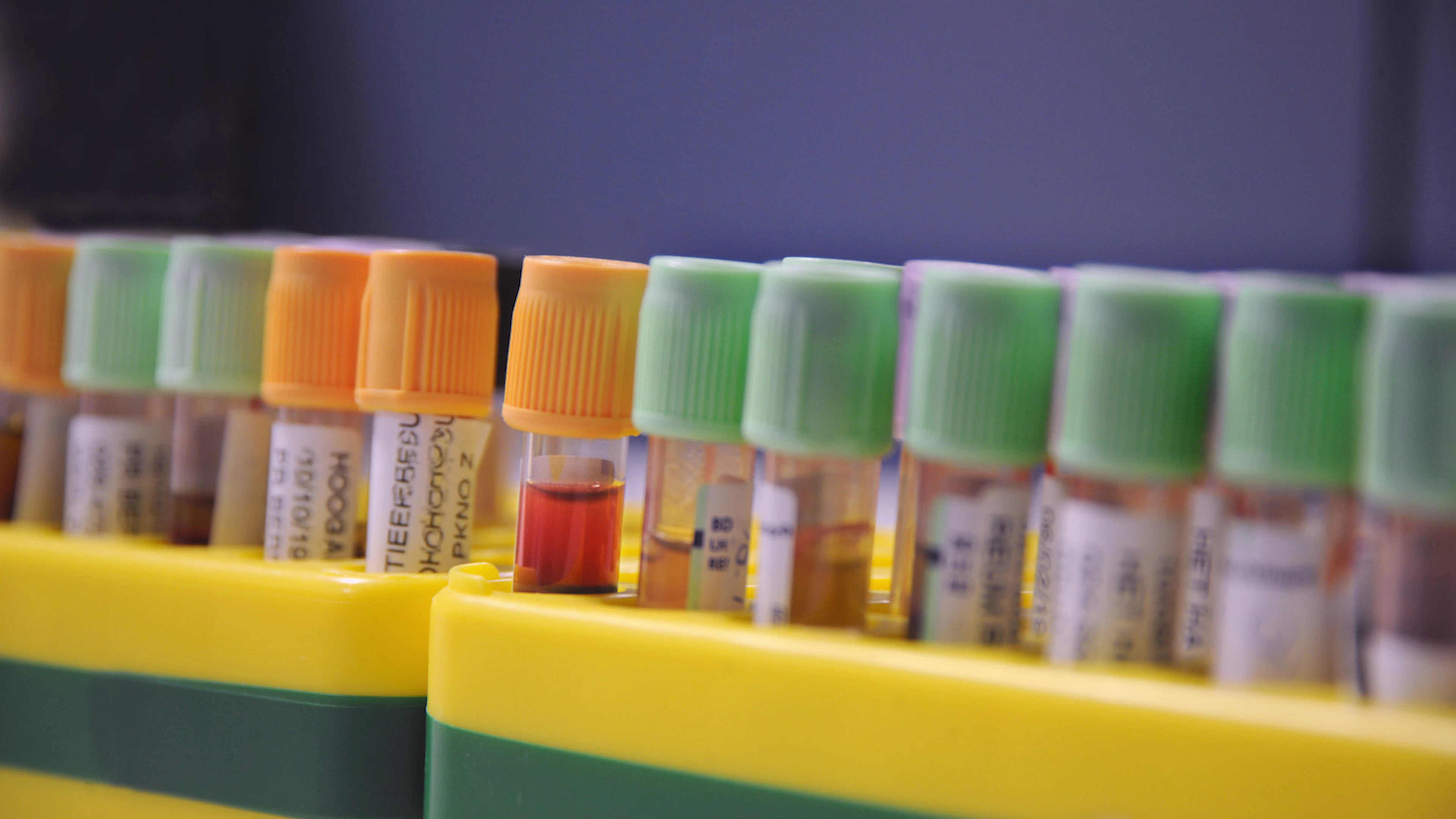 Urinetest spoort uitzaaiingen op