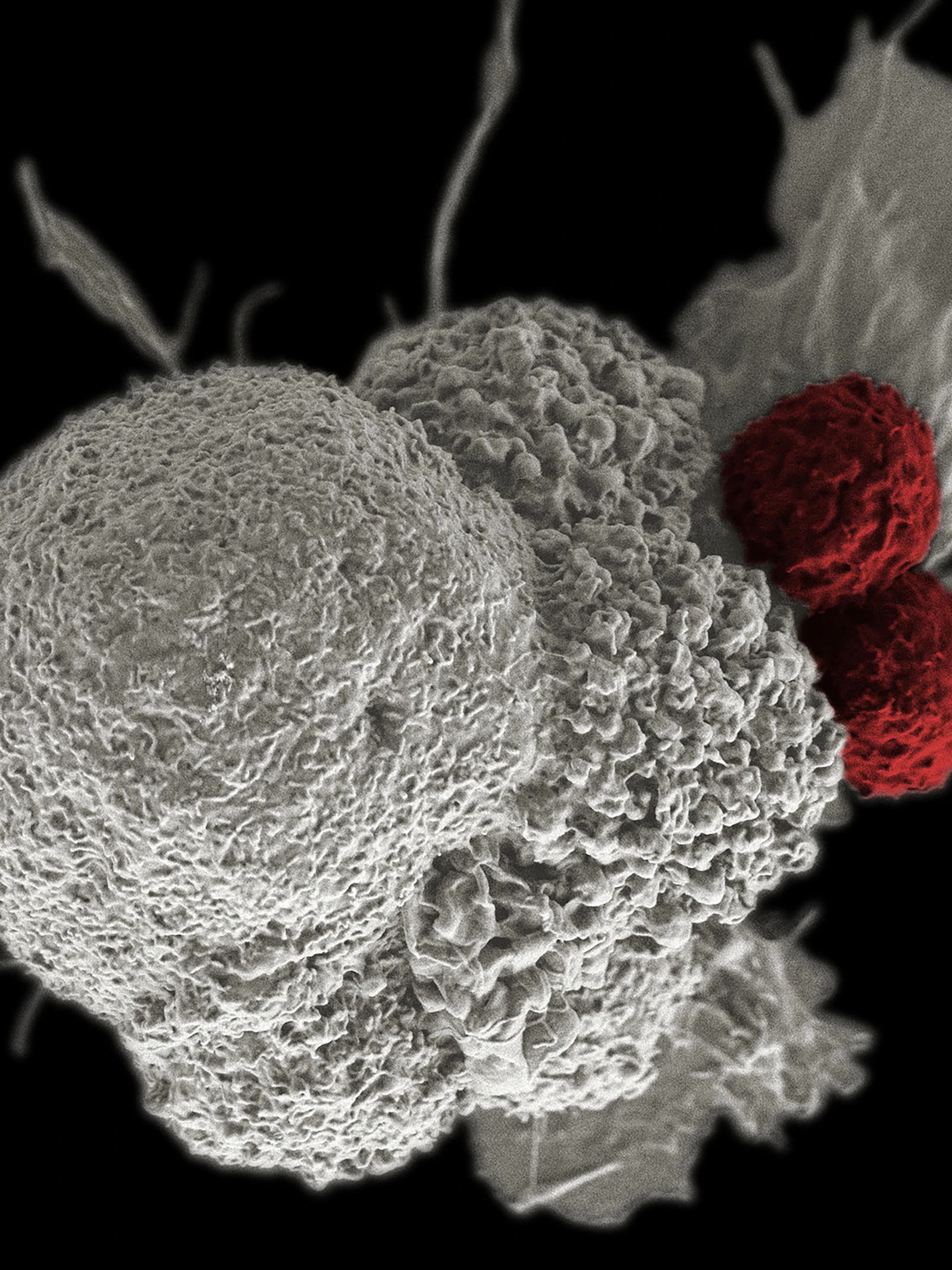 Belangrijke stap in kankertherapie met gentechniek CRISPR