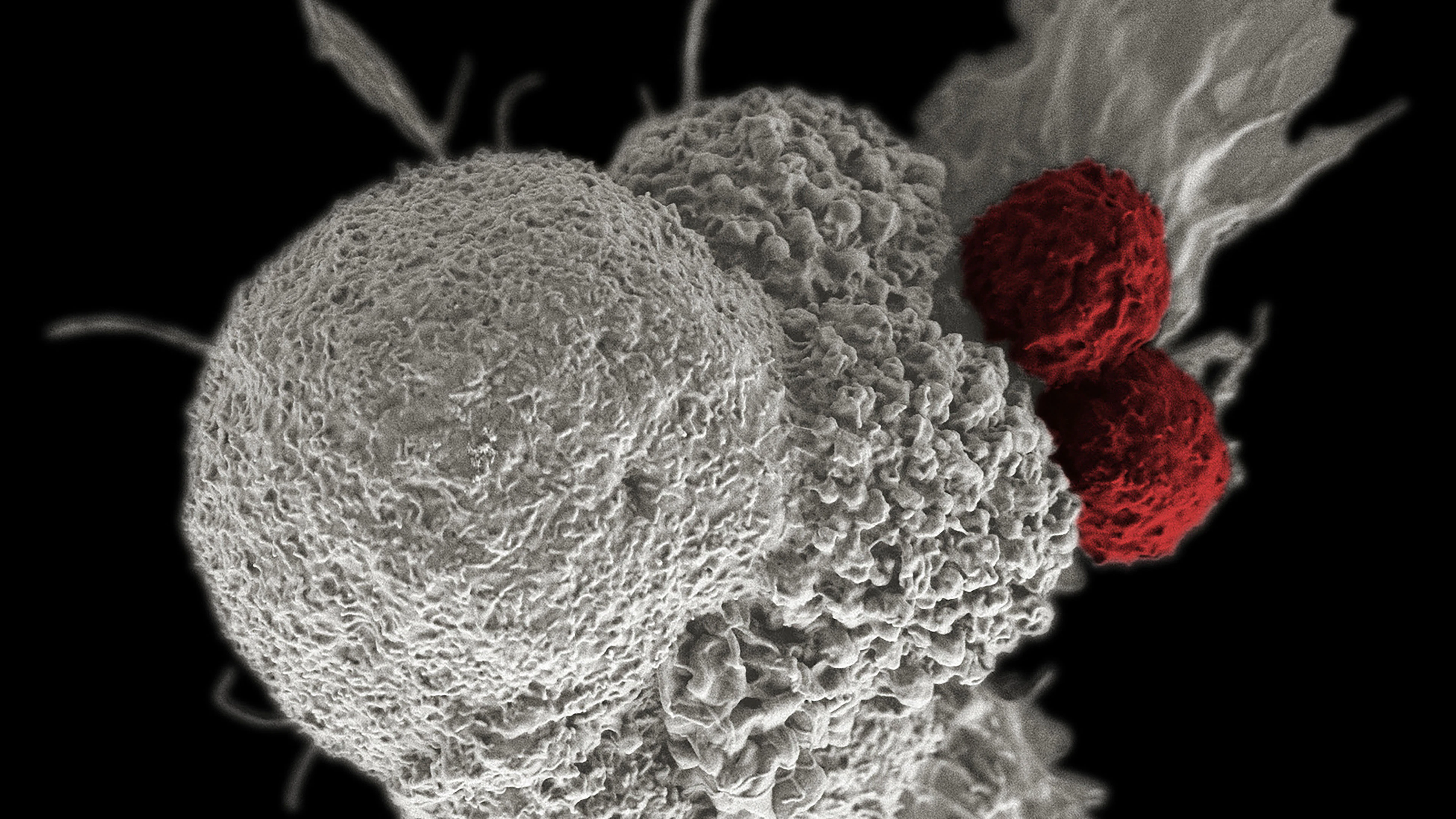Belangrijke stap in kankertherapie met gentechniek CRISPR